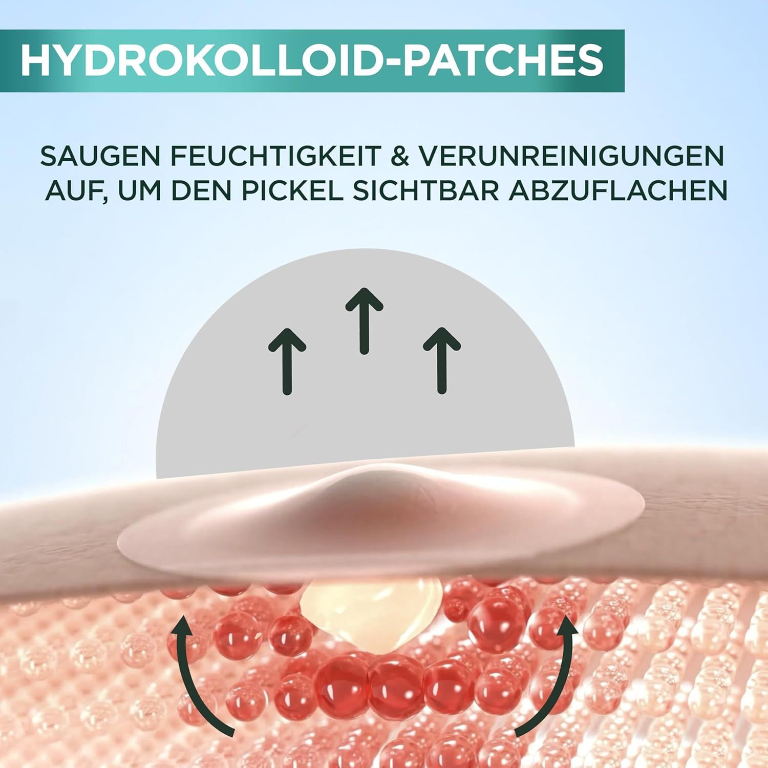 Nahaufnahme eines Pimple Patch. Pfeile zeigen die Aufnahme von Feuchtigkeit und Verunreinigungen an. Text: Hydrokolloid-Patches.