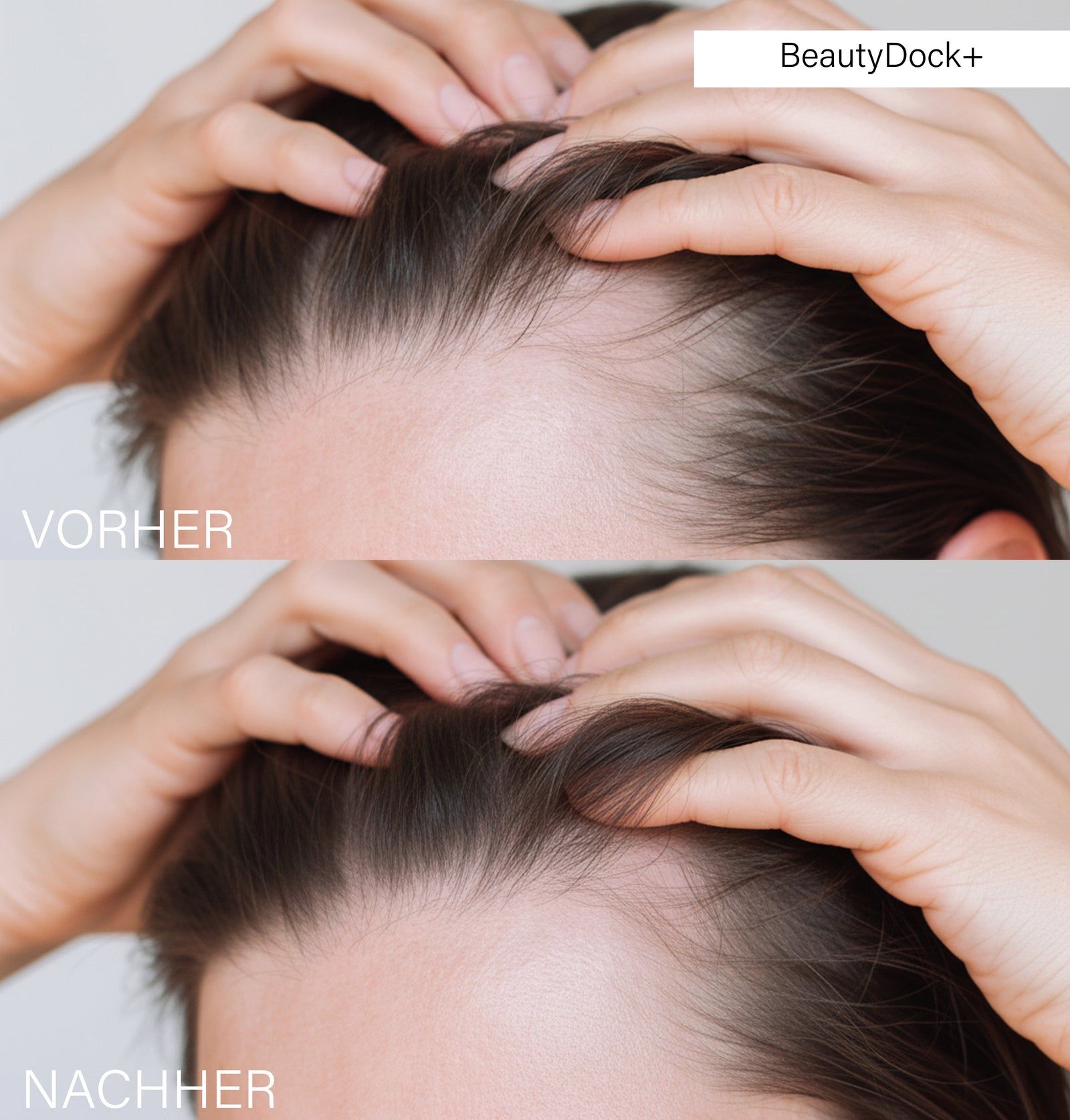 Vergleich von Kopfhaut: Vorher und Nachher. BeautyDock+ beschriftet. Haare dünn, dann voller.