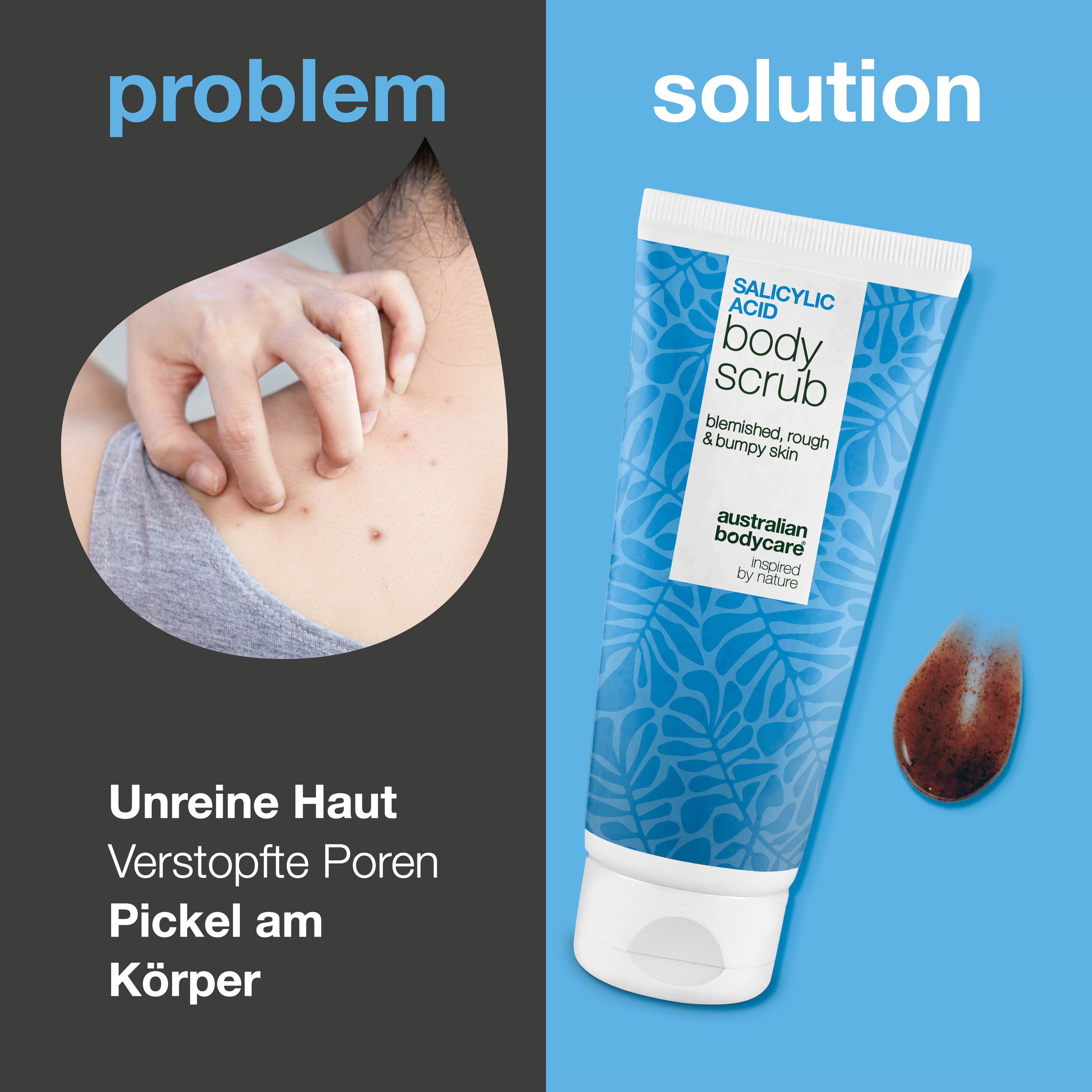 Vergleich: unreine Haut und Body Scrub. Tube mit Body Scrub. Braunes Produkt daneben. Text: Salicylsäure.