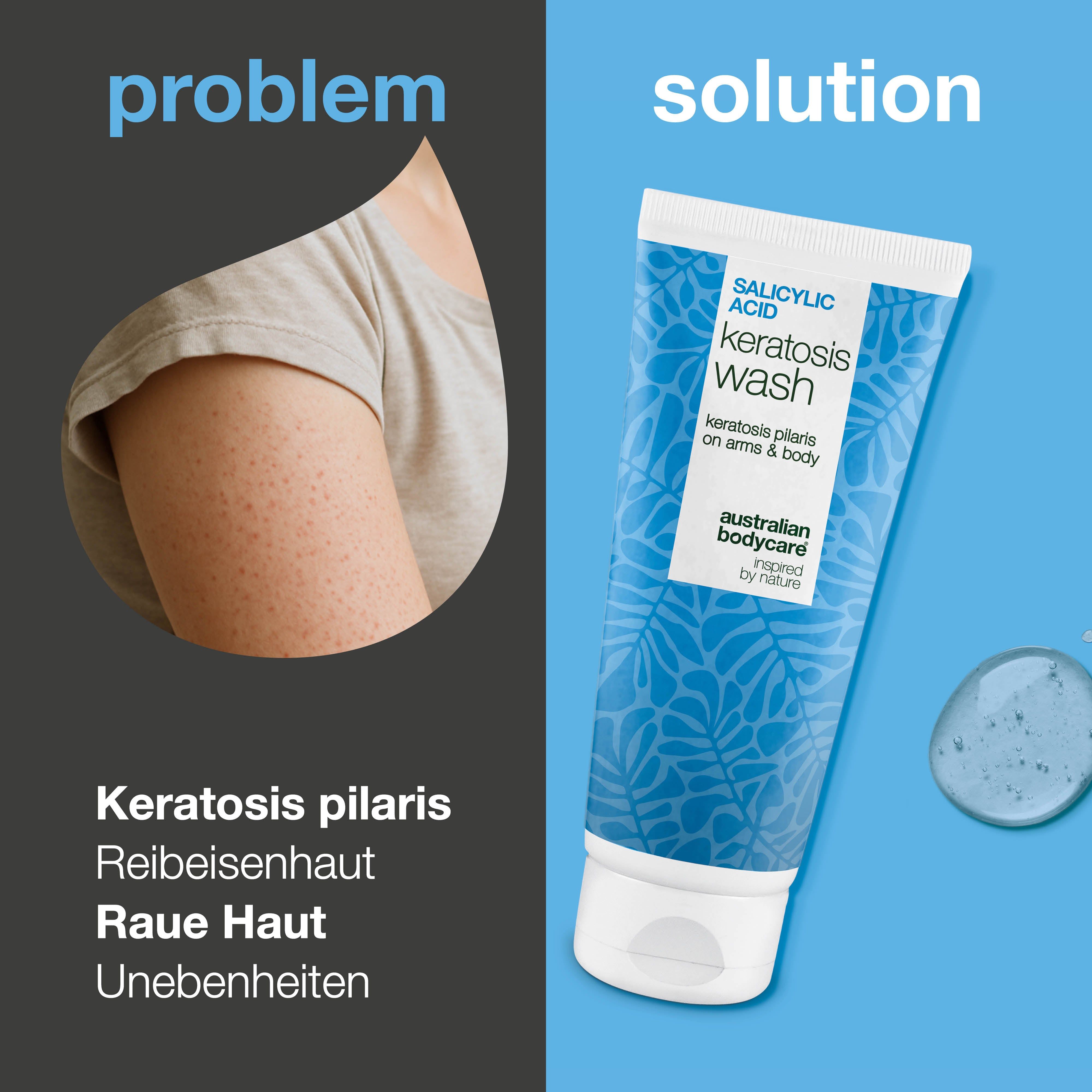 Vergleich: Arm mit Hautunreinheiten und Tube. Text: Salicylsäure Keratosis Wash. Marke: Australian Bodycare.