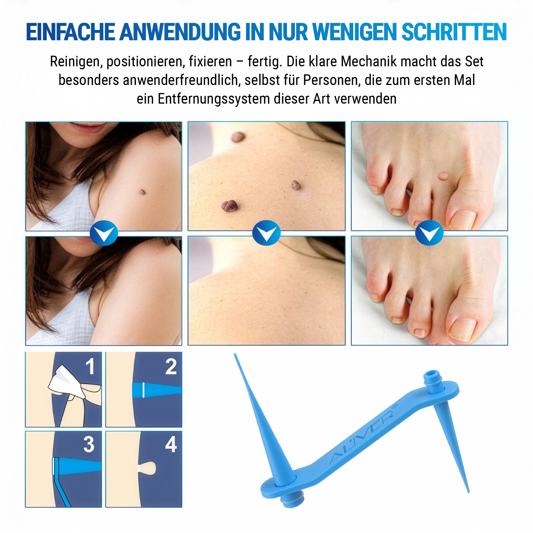 Illustrationen der Anwendungsschritte. Applikator und Hautstellen. Text: EINFACHE ANWENDUNG IN NUR WENIGEN SCHRITTEN.