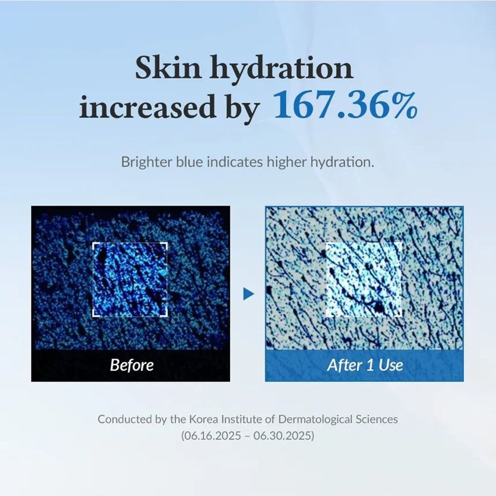 Vorher-Nachher-Vergleich. Hautfeuchtigkeit um 167,36% erhöht. Blaue mikroskopische Bilder. Text: Korea Institute of Dermatological Sciences.