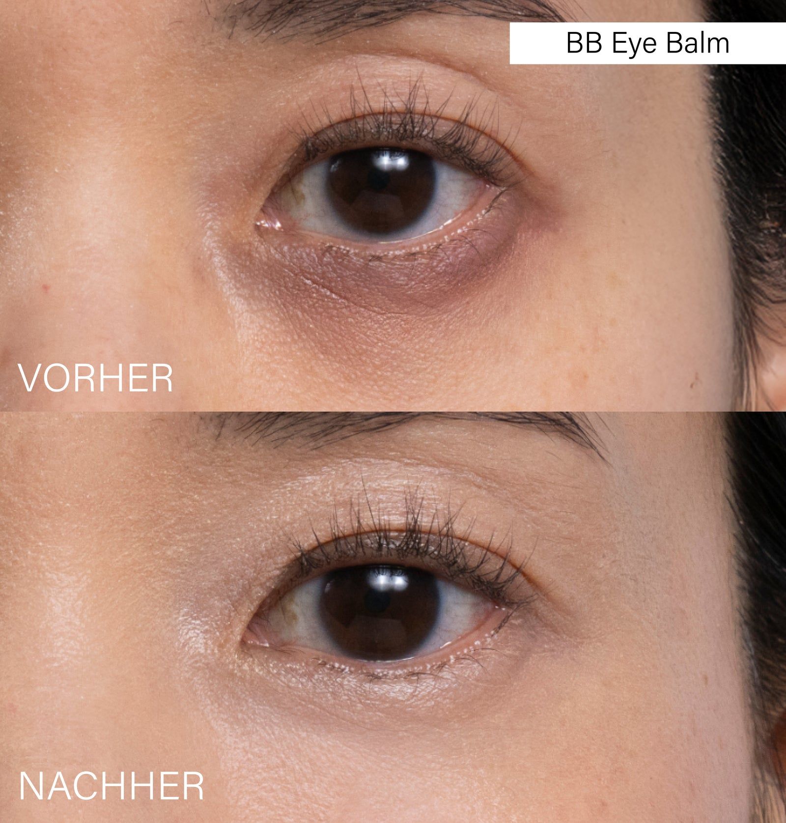 Vorher-Nachher-Vergleich der Augenpartie. BB Eye Balm-Produktbezeichnung.