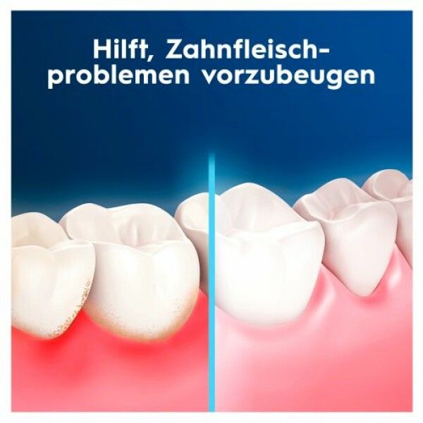 Vergleich von Zähnen vor und nach der Reinigung. Text: Hilft, Zahnfleischproblemen vorzubeugen.
