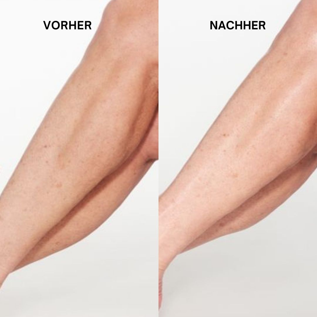 Beine vor und nach der Anwendung. Haut wirkt glatter und hydratisierter.