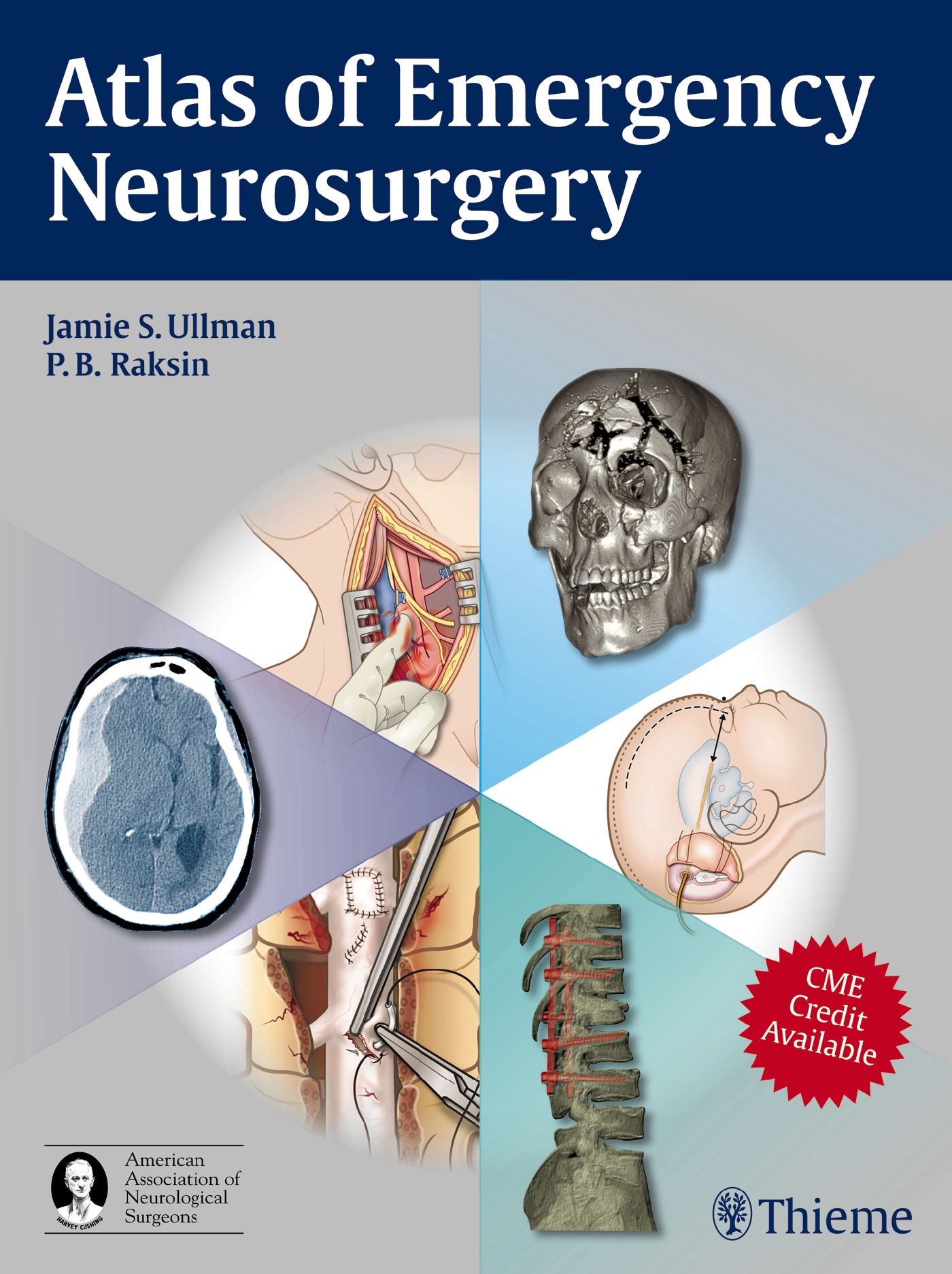 Buchcover: Atlas of Emergency Neurosurgery. Illustrationen von Schädel, Gehirn-CT, Operationen. Autoren: Jamie S. Ullman, P.B. Raksin. Verlag Thieme.