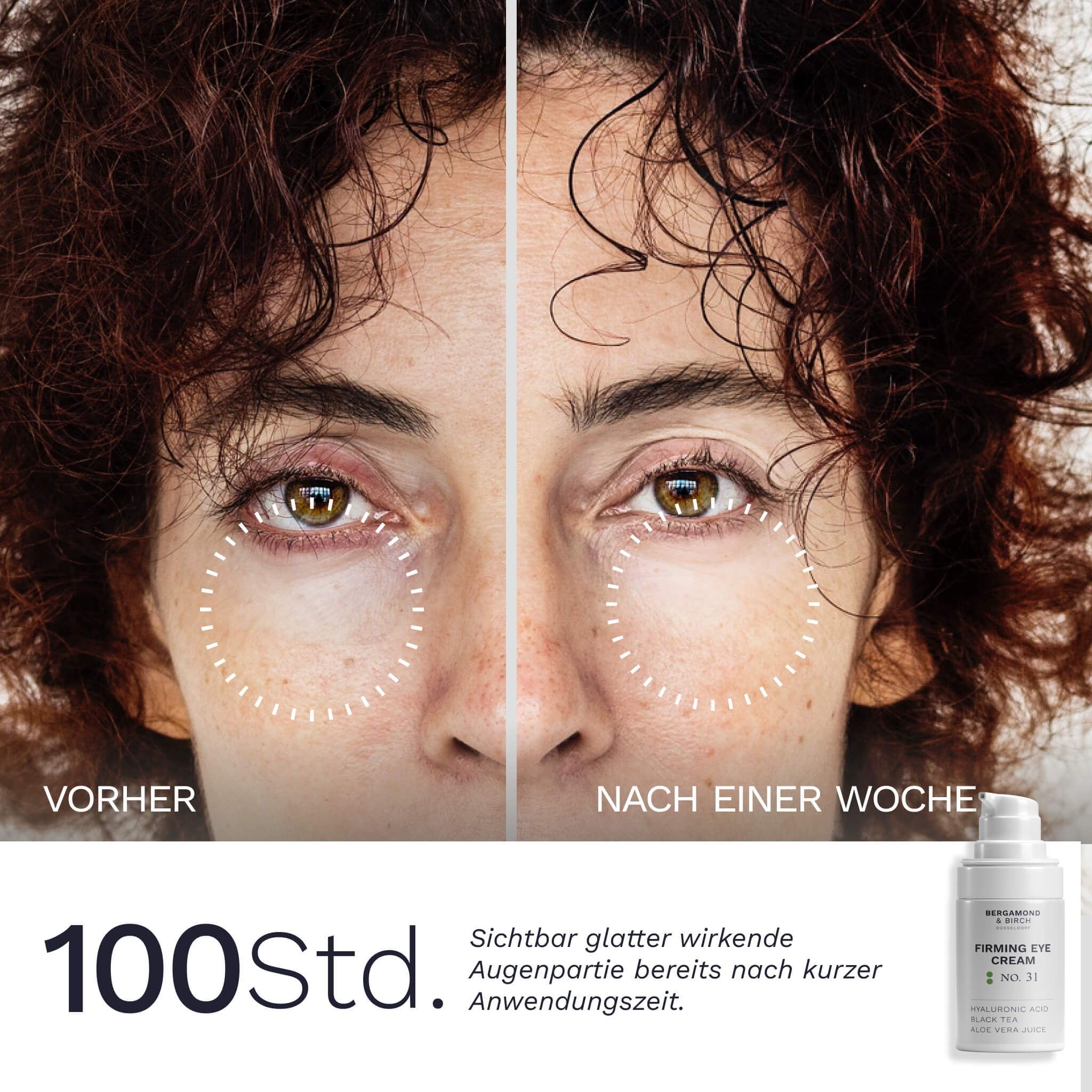 Gesicht einer Frau, geteilt. Links: Vorher. Rechts: Nach einer Woche. Produktabbildung unten rechts.