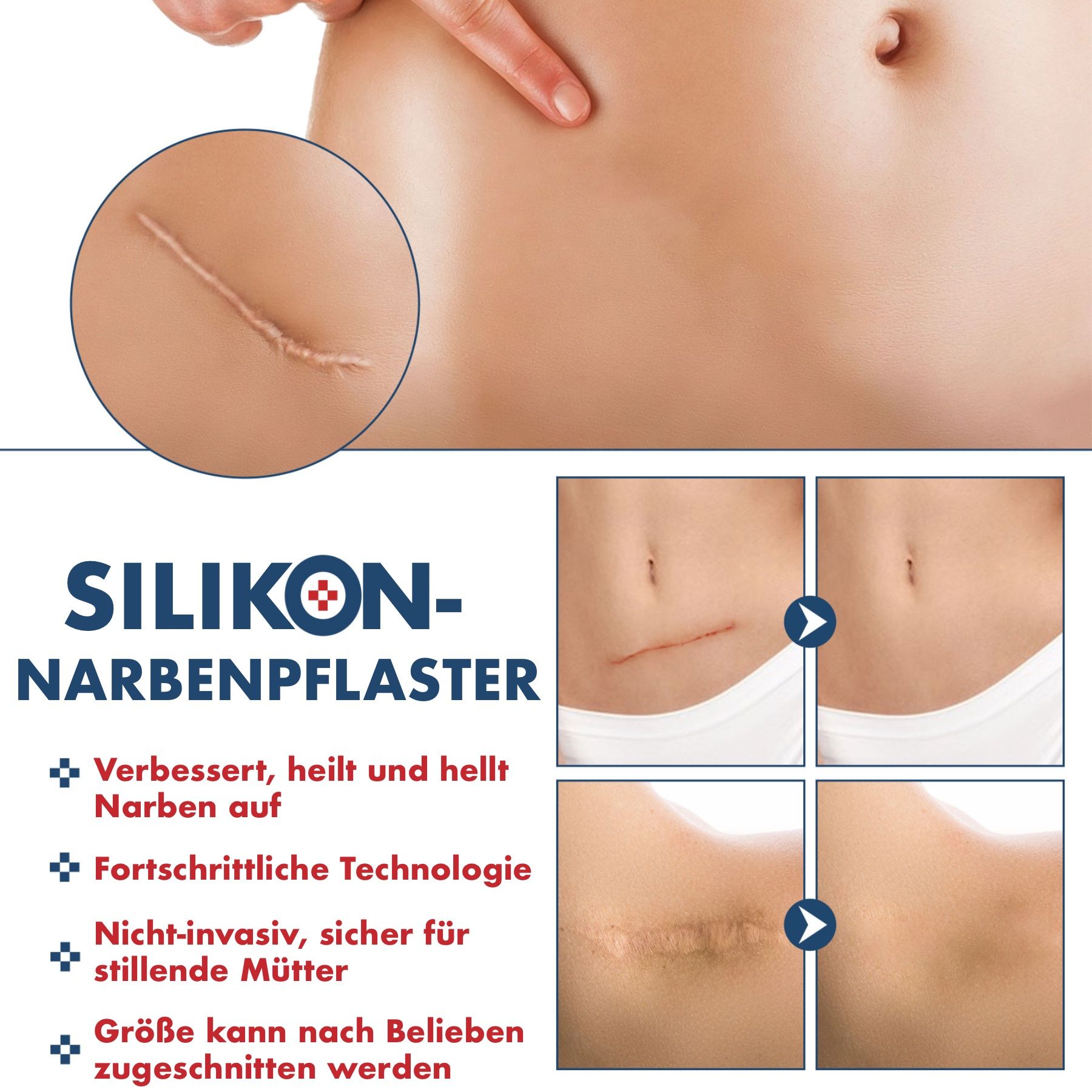 P-Beauty Silikonpflaster Narbenpflaster Wundpflaster