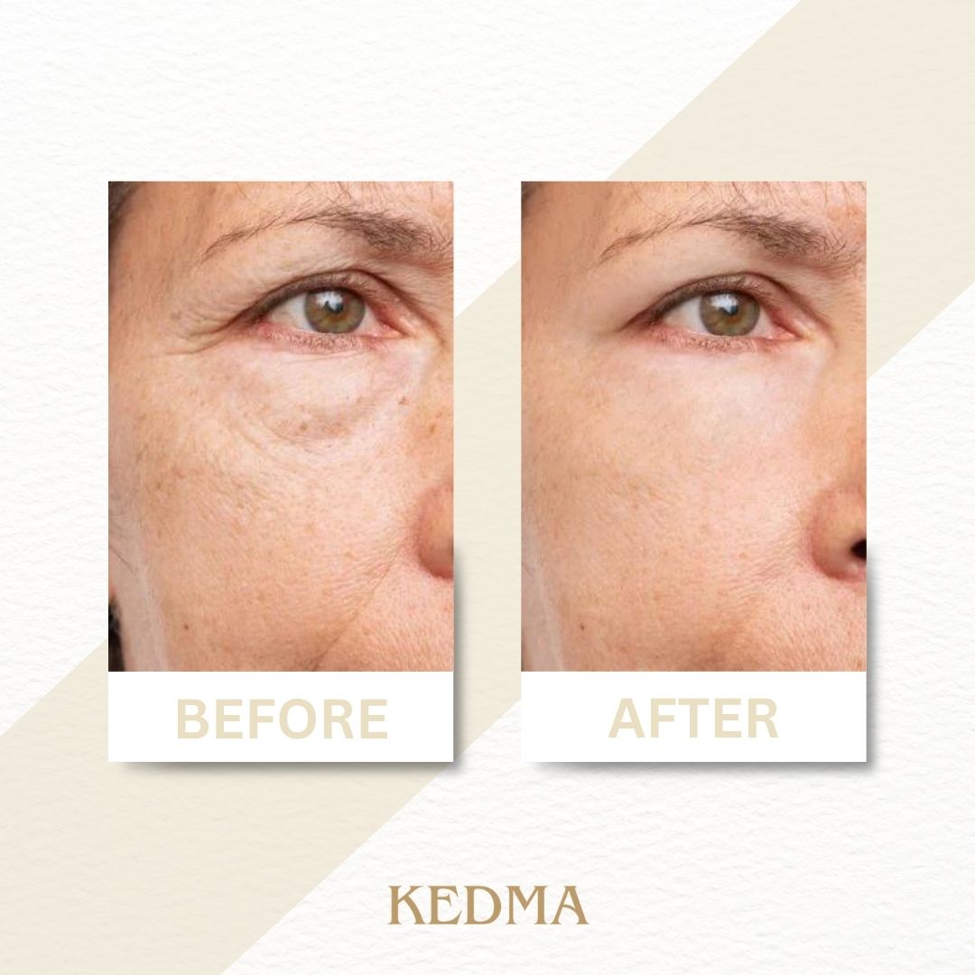 Kedma - Set mit Tages- & Nachtcreme mit Kollagen