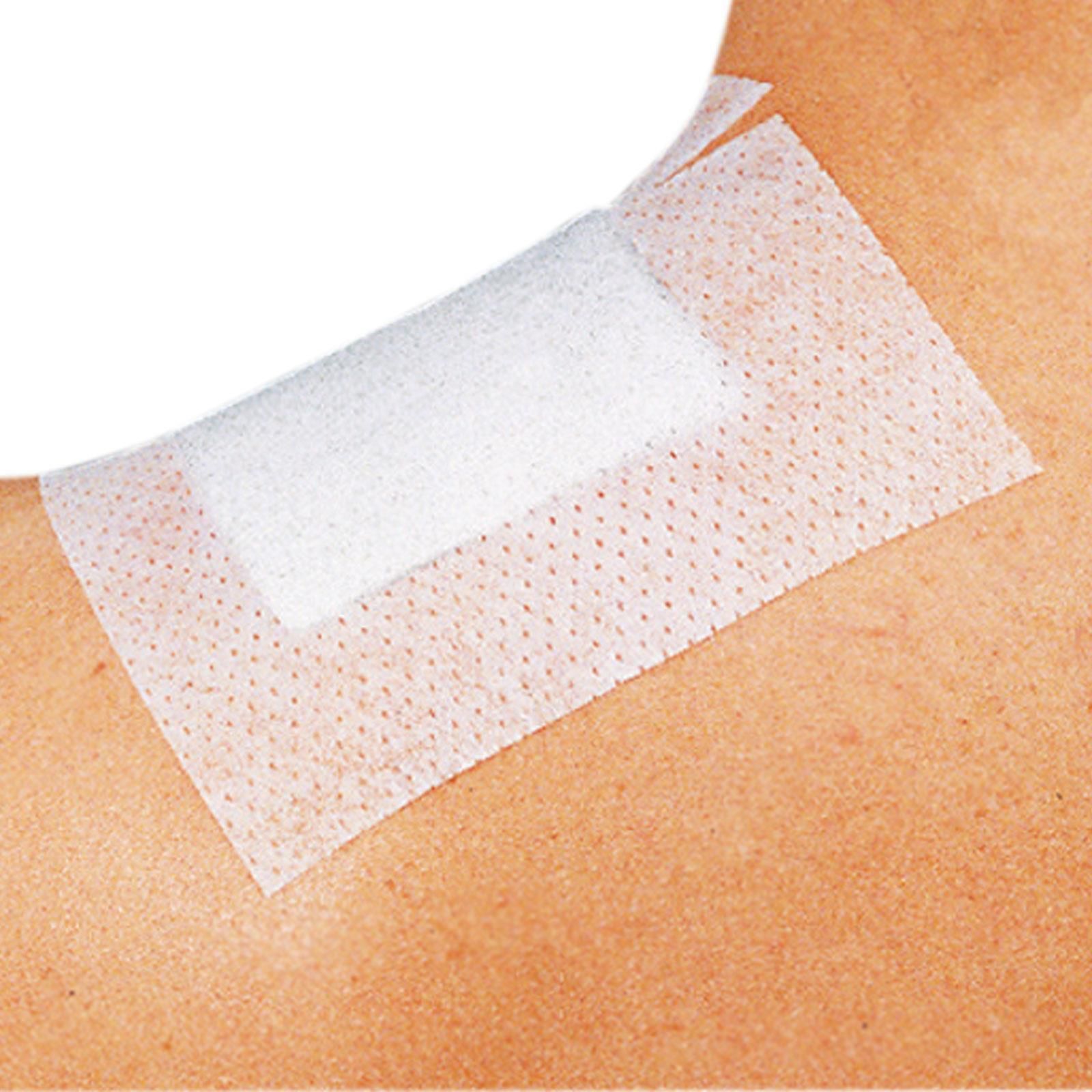 Curafix Fixierpflaster 15cm x 2m