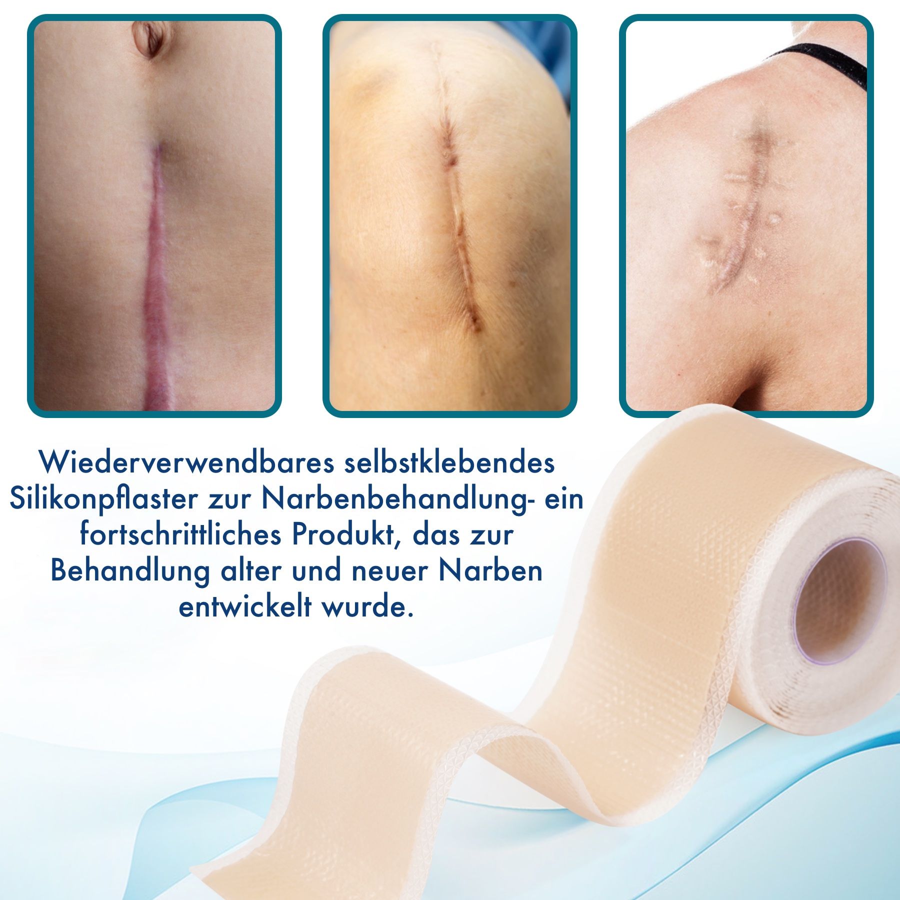 Drei Bilder zeigen Narben vor und nach der Behandlung mit Silikonpflastern. Wiederverwendbar, selbstklebend.