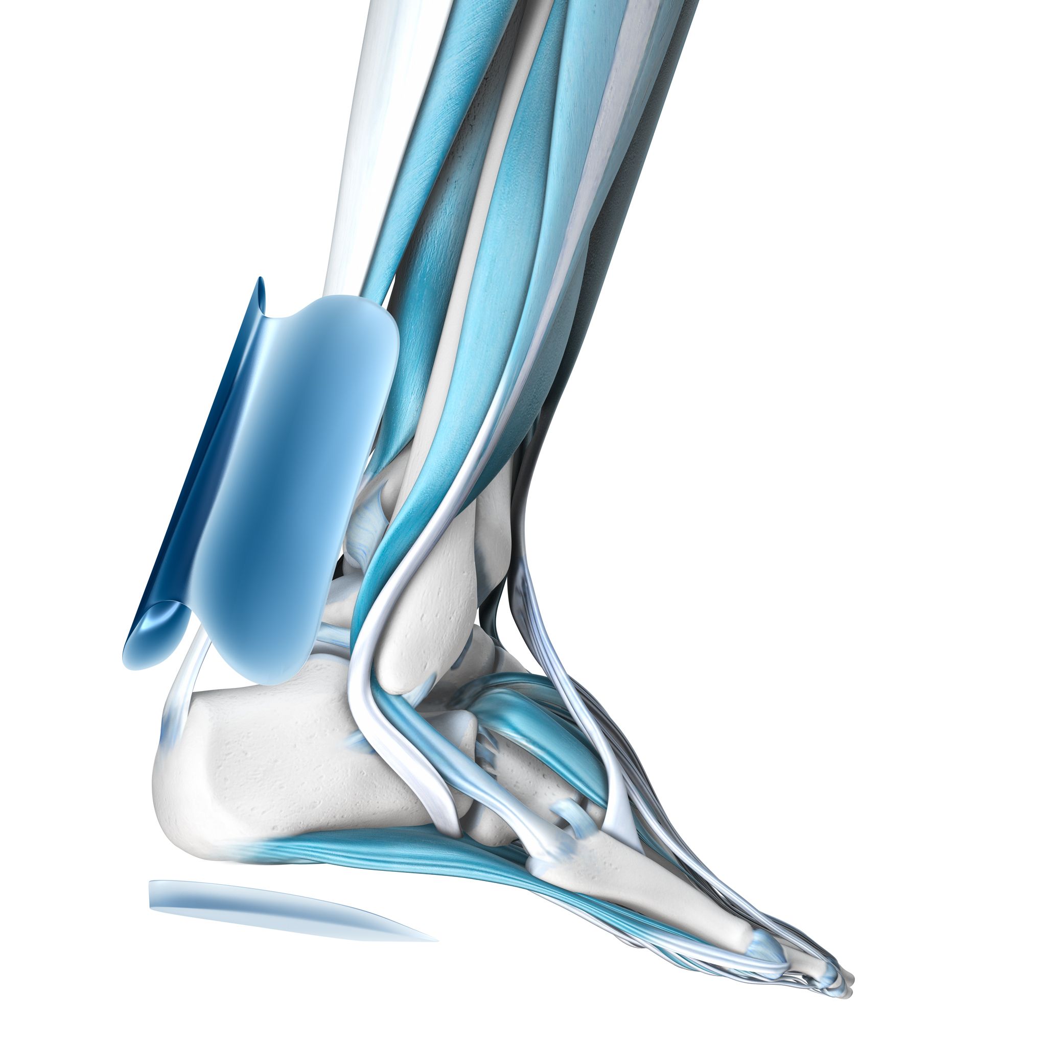 Blaue Kunststoffteile am Knöchel, anatomische Darstellung. Muskeln und Knochen sichtbar.