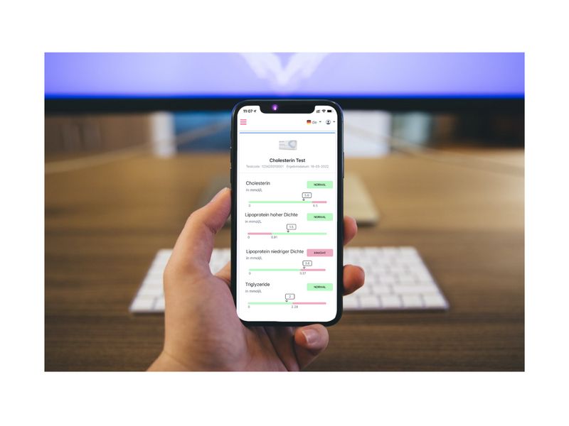 Smartphone mit Cholesterin Test-Ergebnissen. Hand hält Telefon mit Testergebnissen auf dem Bildschirm.