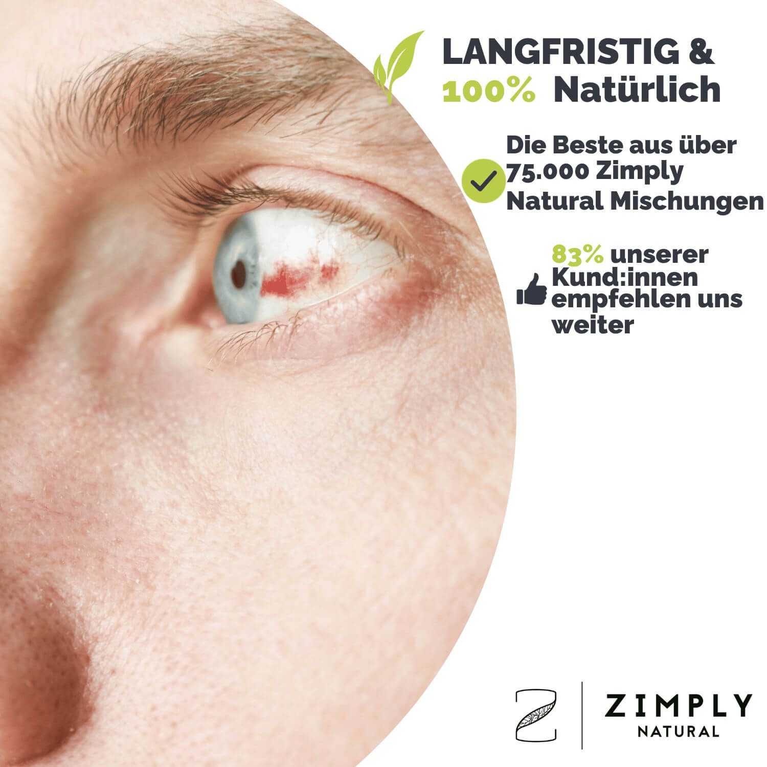 Nahaufnahme eines Auges mit Rötung. Text: Langfristig & 100% Natürlich. Die Beste aus über 75.000 Mischungen. 83% empfehlen uns weiter. Logo: ZIMPLY NATURAL.