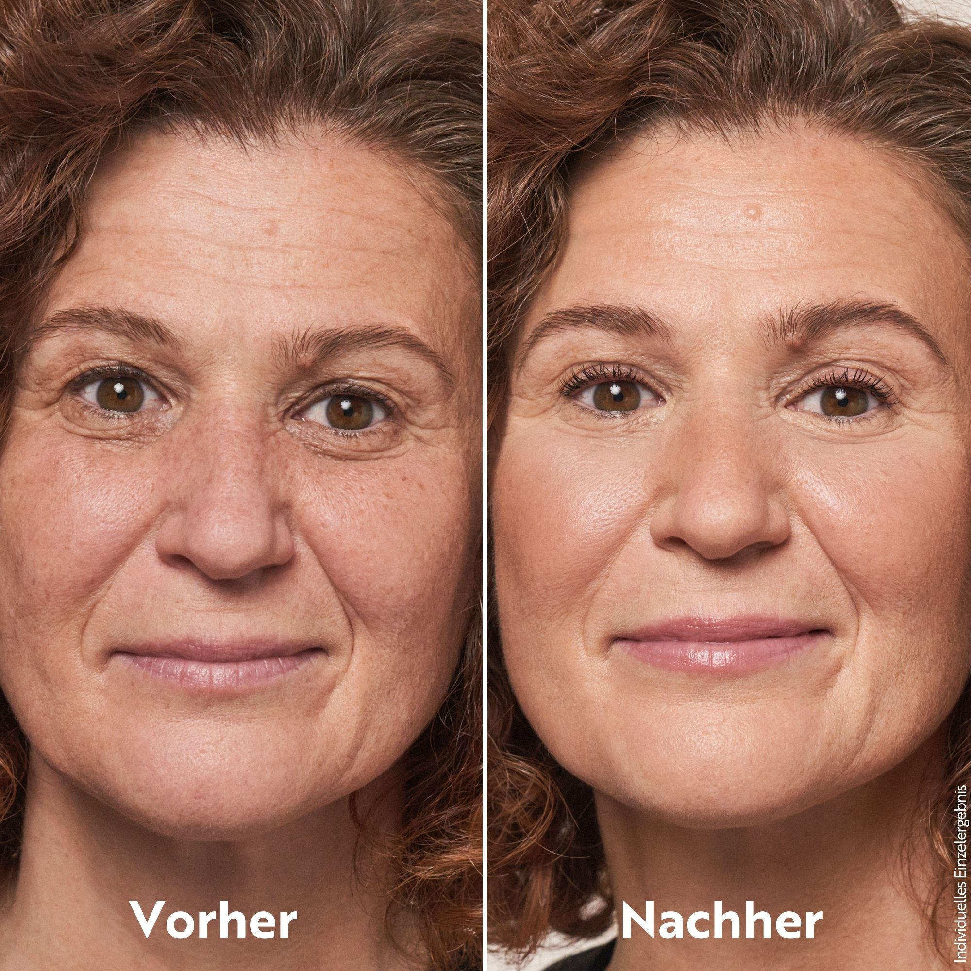 Vorher-Nachher-Vergleich. Gesicht einer Frau vor und nach dem Auftragen von Make-up. Deutliche Verbesserung des Hautbildes.