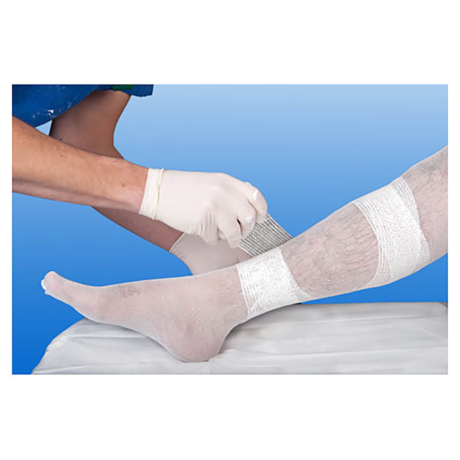 Bein mit Zinkleimbinde. Eine Person in Handschuhen wickelt das Bein mit der Bandage ein. Die Bandage ist weiß und hat eine grobe Textur.