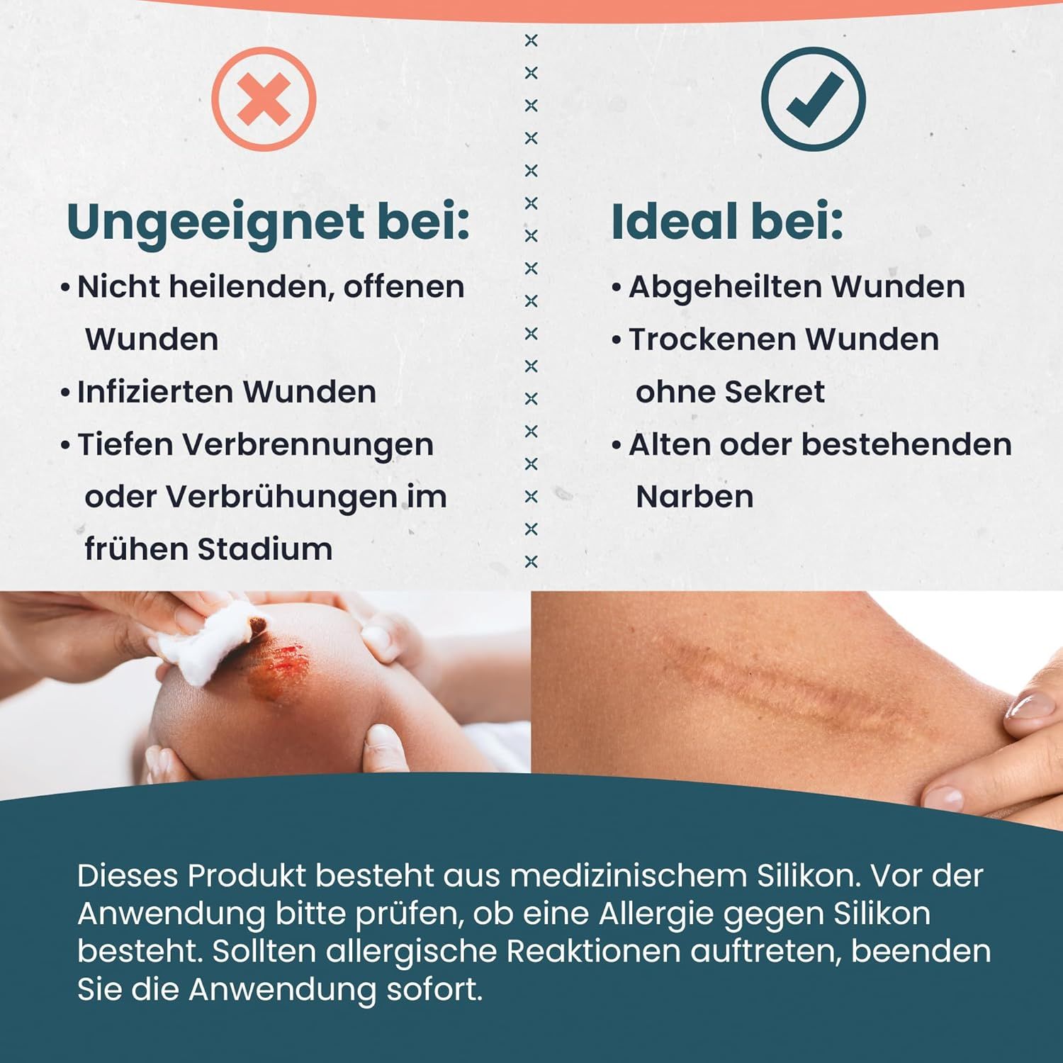 Vergleich: Nicht geeignet bei offenen Wunden, Infektionen, Verbrennungen. Ideal bei abgeheilten Wunden, ohne Sekret, alten Narben.