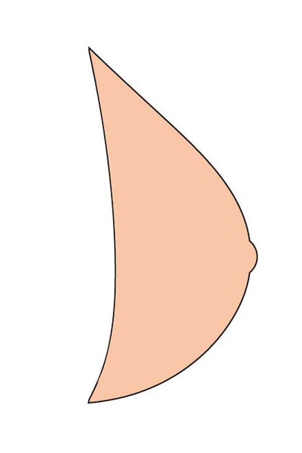 Hautfarbene Brustprothese, Seitenansicht. Dreieckige Form mit abgerundeten Kanten und einer kleinen Erhebung.