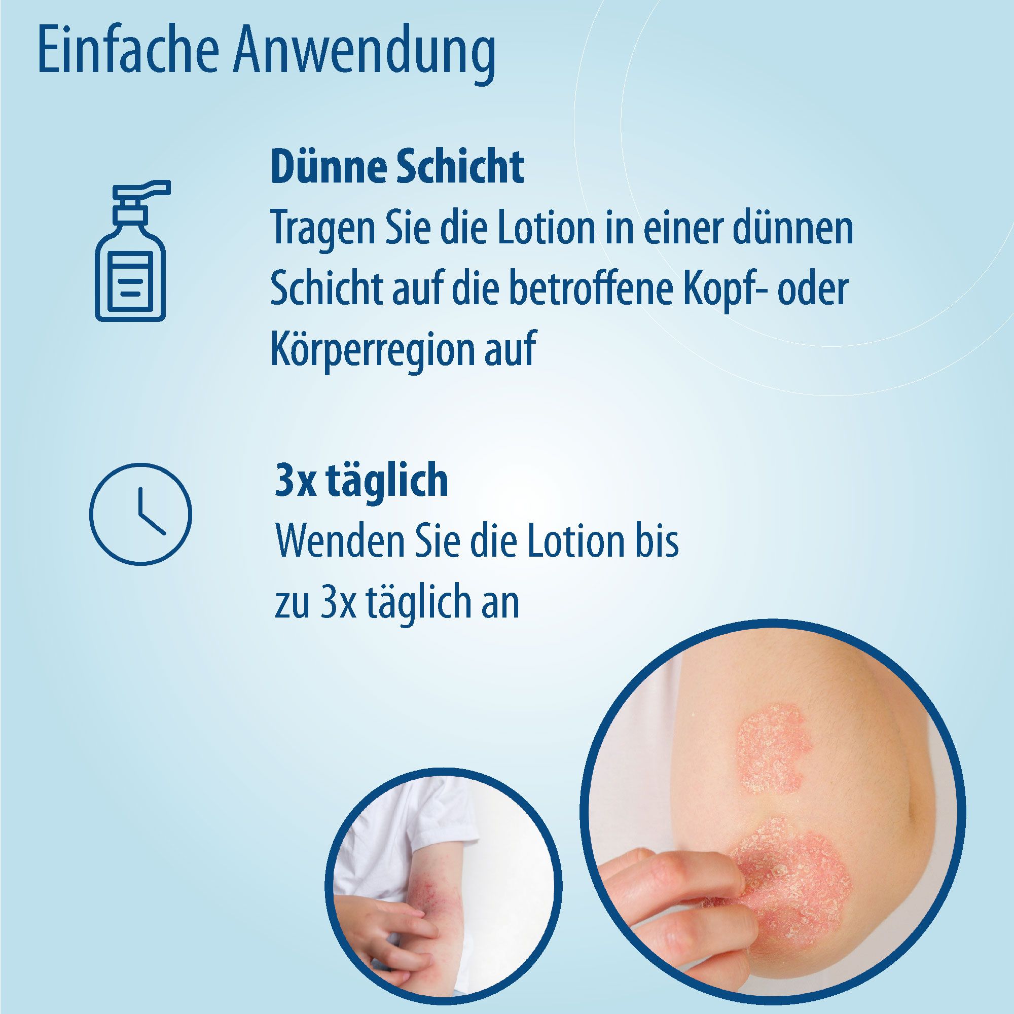 Grafik mit Anwendungshinweisen. Text: Dünne Schicht auftragen, 3x täglich. Bild: Arm mit Hautausschlag.