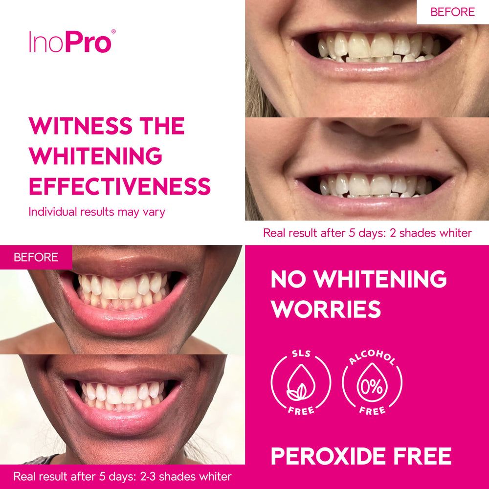 INOPRO - Peroxidfreie Zahnweiß-Streifen