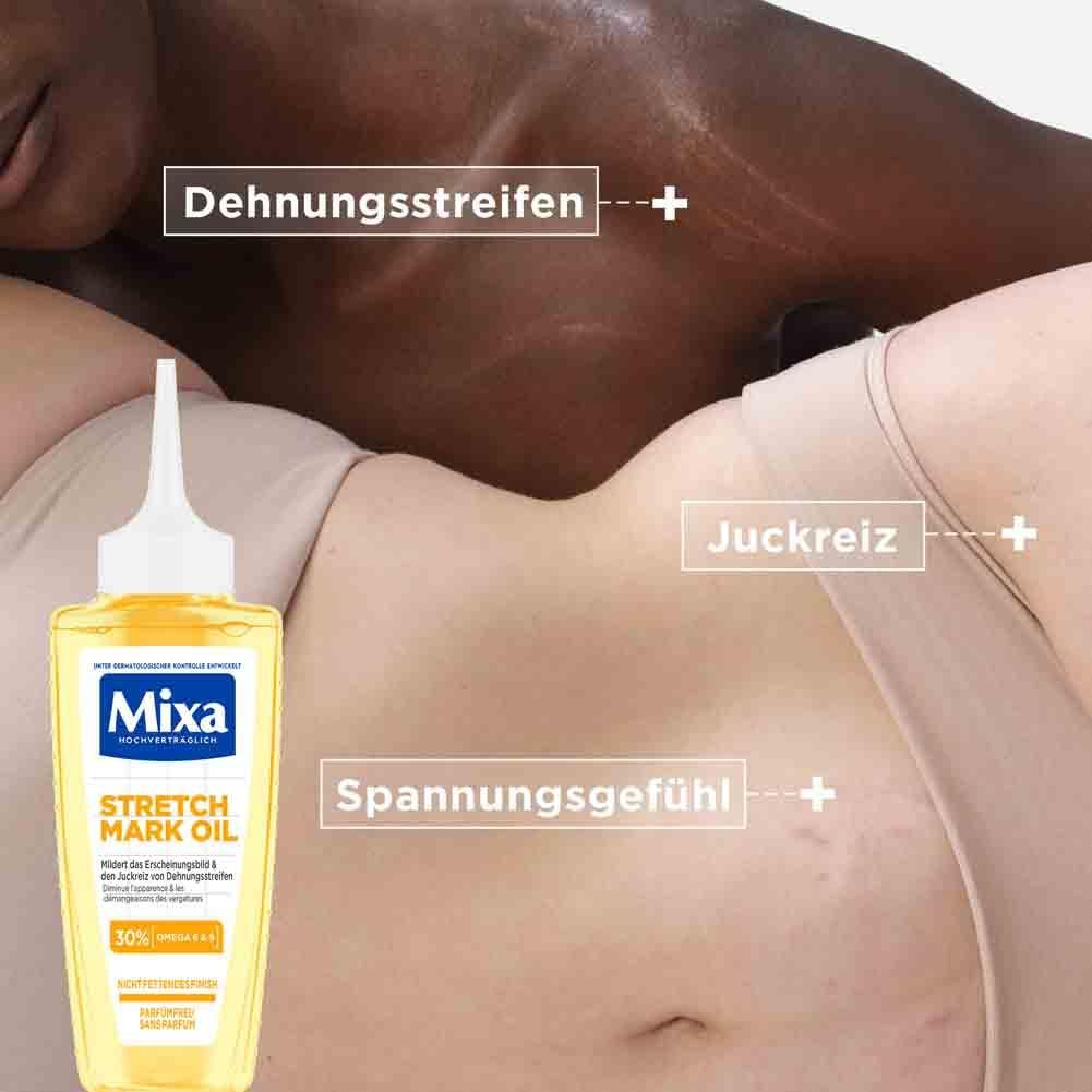 Gelbe Flasche mit weißem Applikator neben Hautpartien. Aufschrift Mixa Stretch Mark Oil. Text: Dehnungsstreifen, Juckreiz, Spannungsgefühl.
