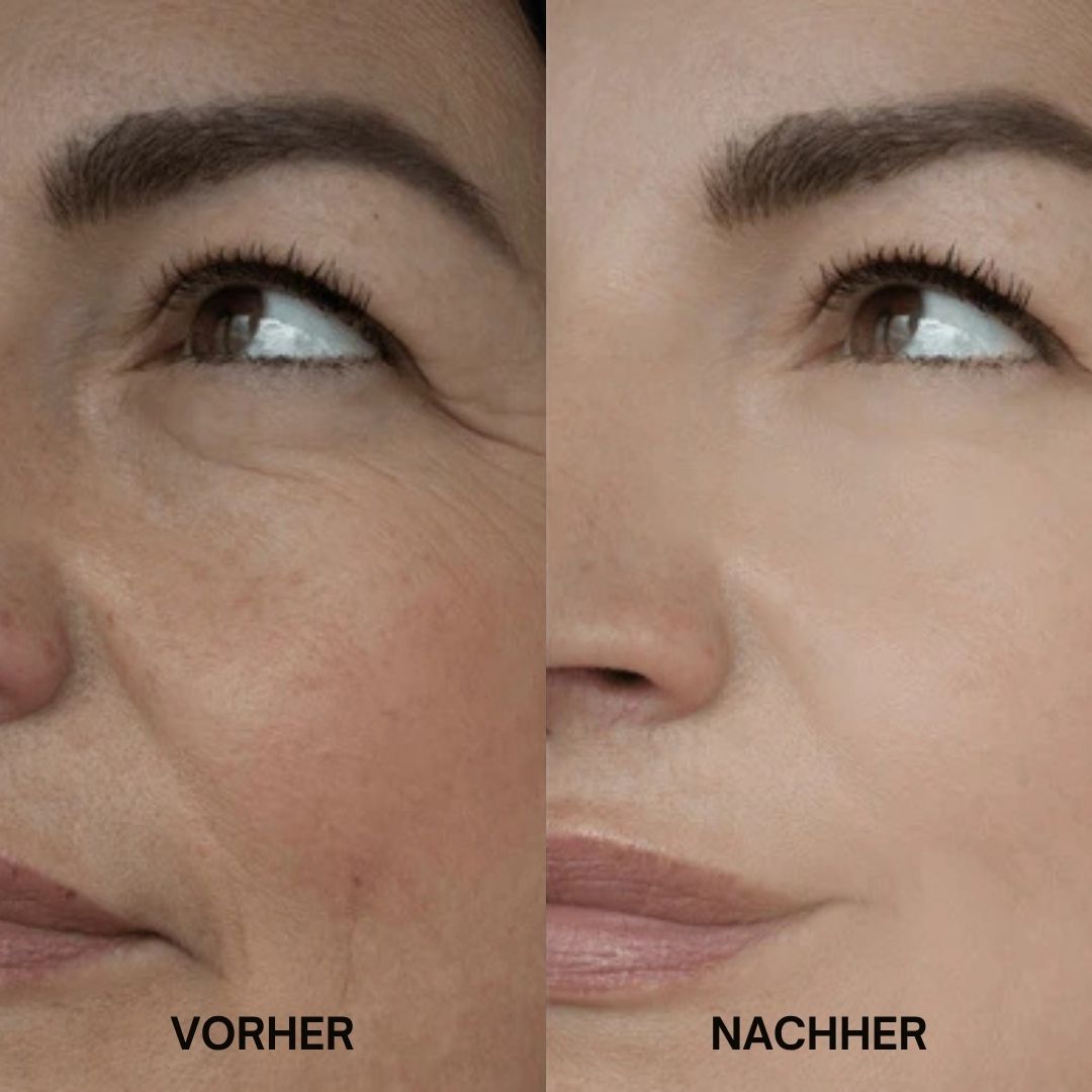 Vorher-Nachher-Vergleich von Haut. Links: Haut mit Falten. Rechts: Glatte Haut. Keine Produktbezeichnung sichtbar.