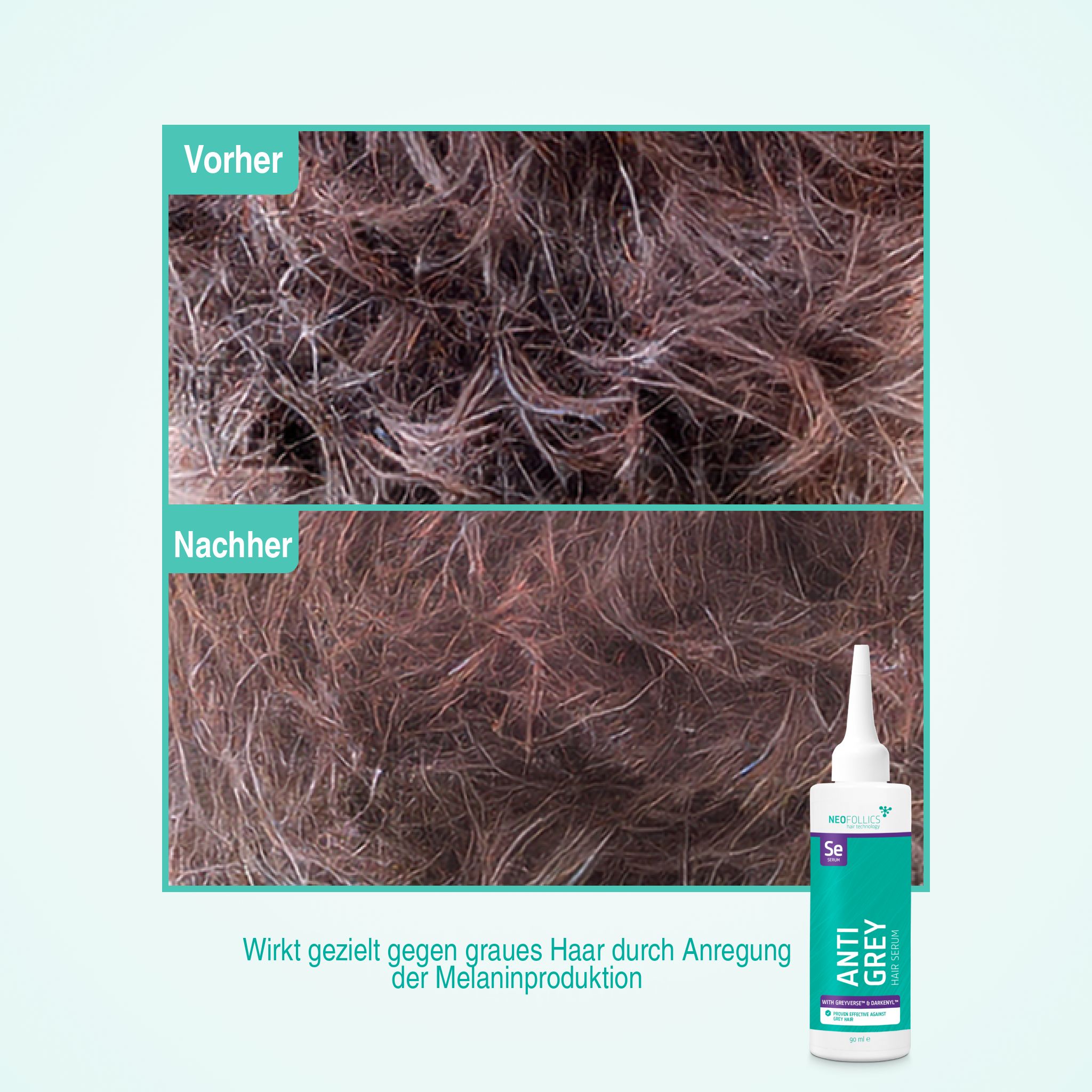 Vorher-Nachher-Vergleich von Haaren, behandelt mit Neofollics Anti-Grauhaar-Serum.