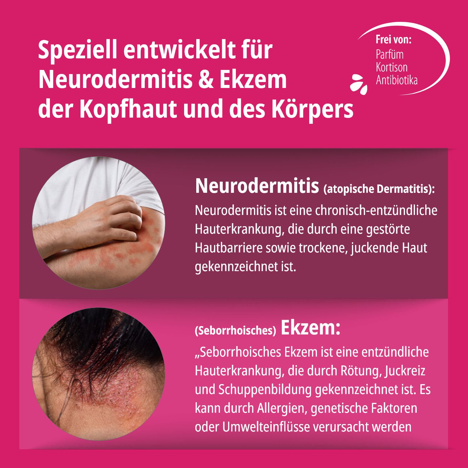 Evolsin® Ekzem & Neurodermitis Creme Doppelpack - Mindert Juckreiz & beruhigt gereizte Haut