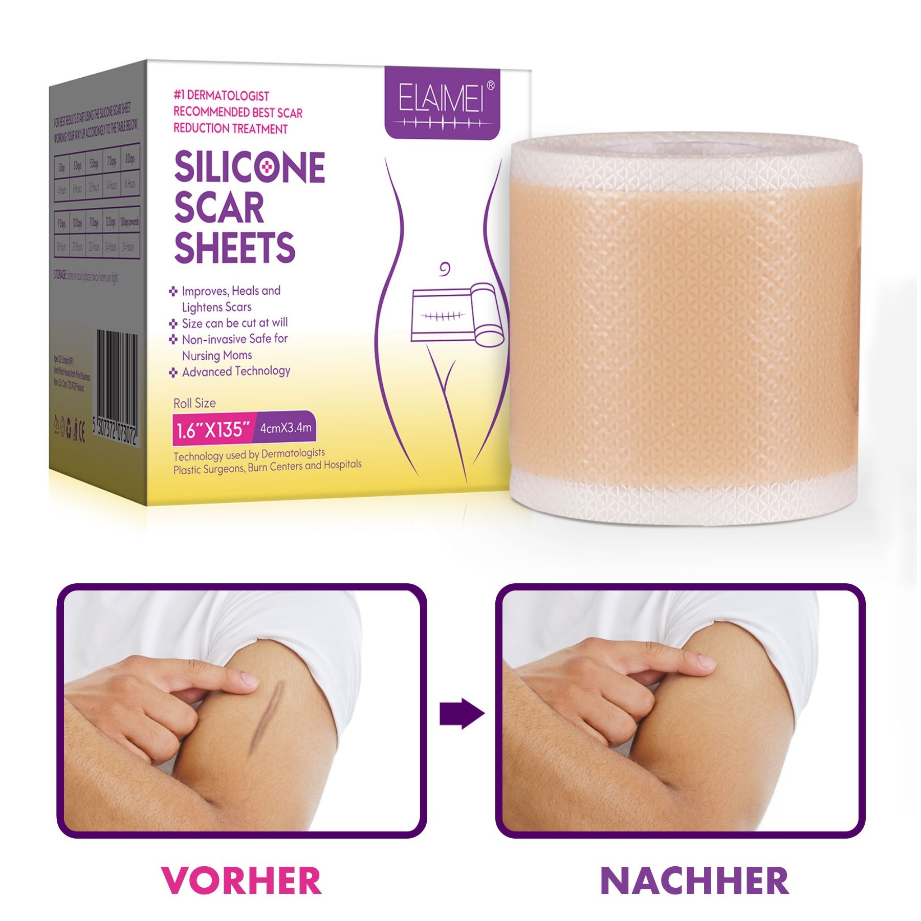 Verpackung und Rolle Silikonpflaster. Vorher-Nachher-Vergleich: Arm mit Narbe, dann gleiche Stelle ohne Narbe.