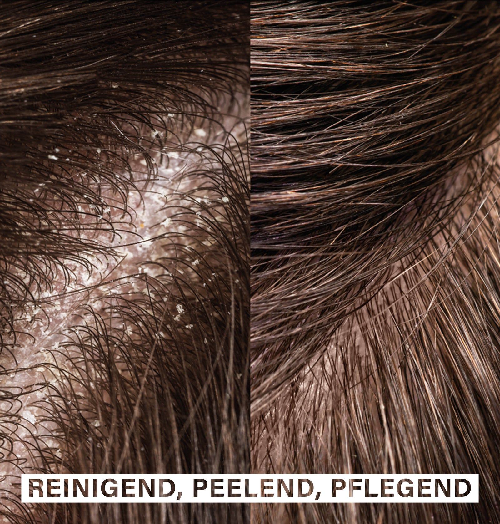 Zwei Ansichten von Kopfhaut. Links: Schuppen. Rechts: Saubere Kopfhaut. Text: REINIGEND, PEELEND, PFLEGEND.