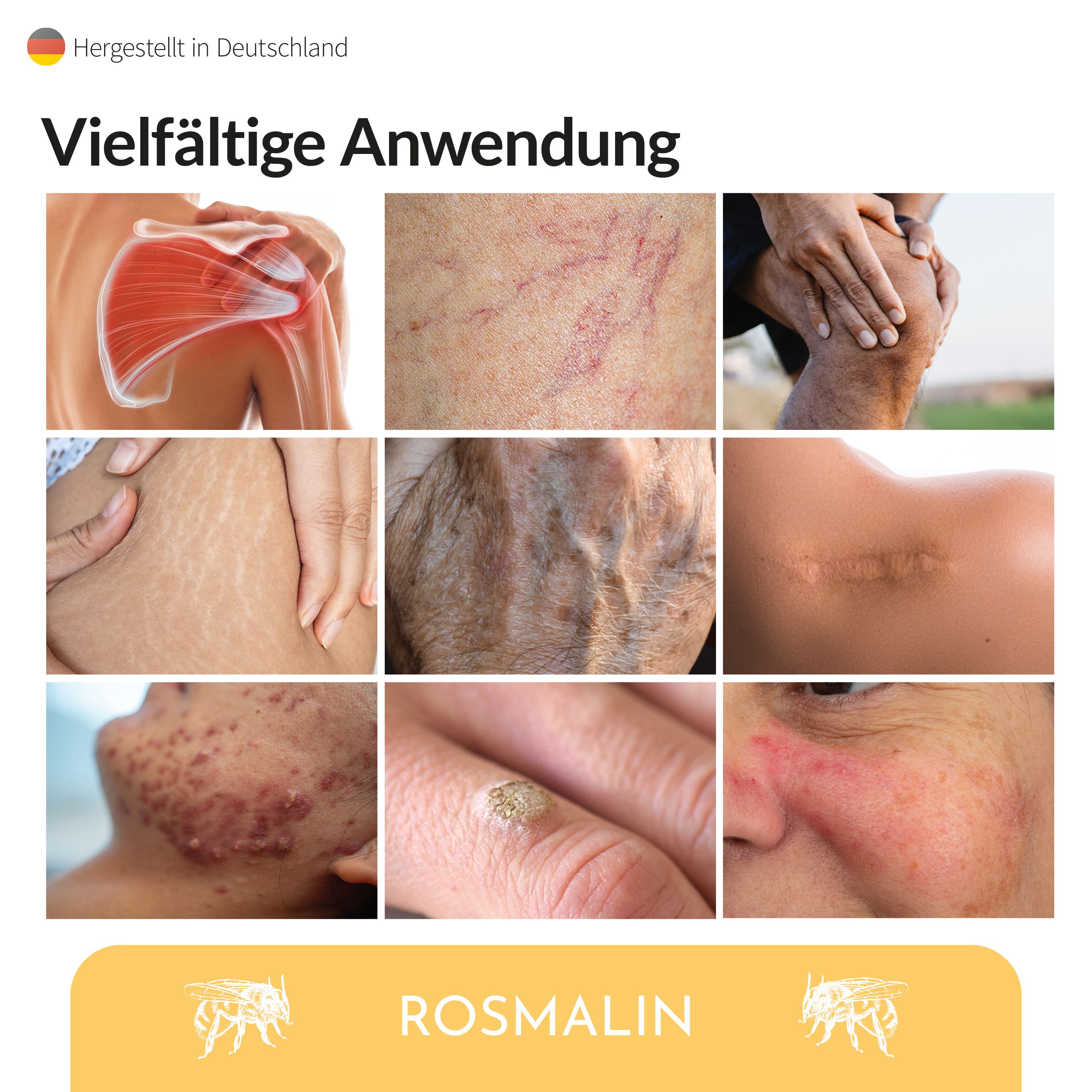 Bilder von Hautpartien mit verschiedenen Hautproblemen. Logo Rosmalin.