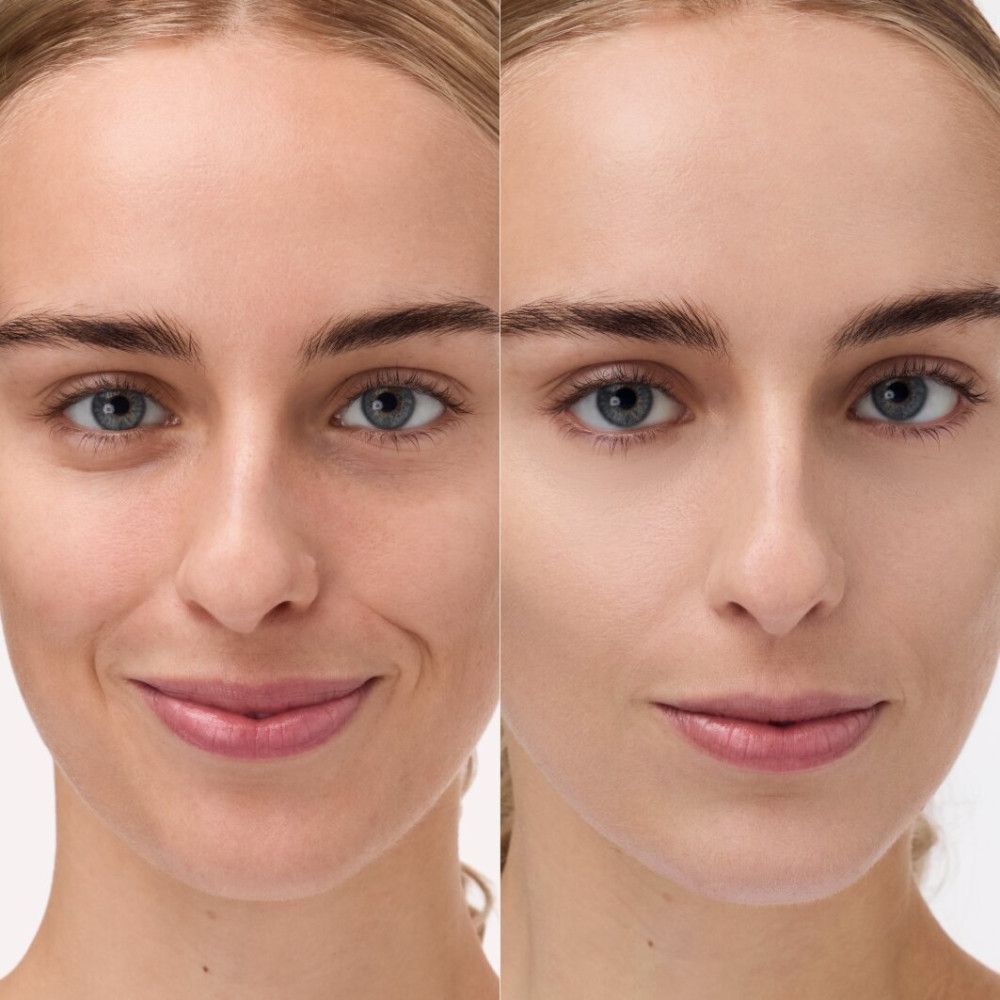 Gesicht einer Frau vor und nach dem Auftragen von Catrice CC Skin Perfector. Links: Haut mit Unreinheiten. Rechts: Haut mit ebenmäßigem Teint.