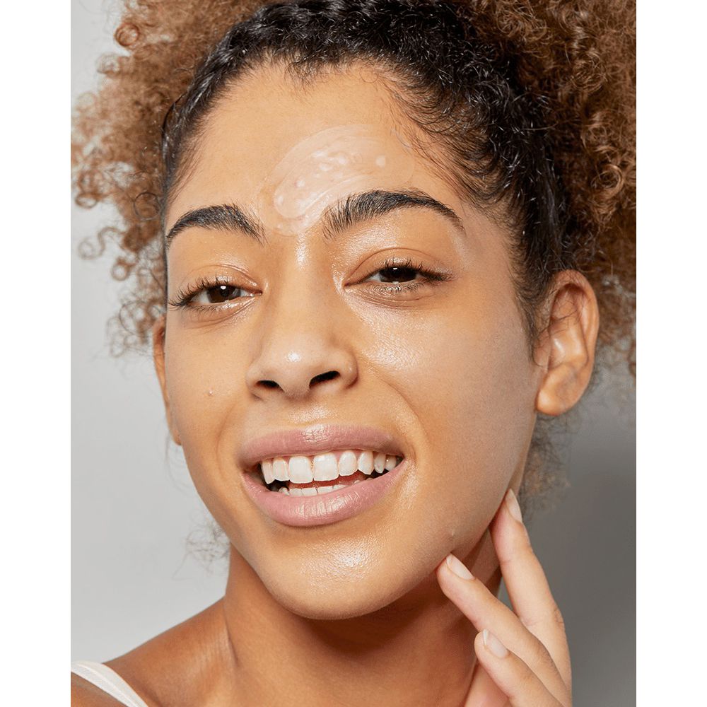 Nahaufnahme einer Person mit einem Akne-Patch auf der Wange. Die Person lächelt. Die Haut ist glänzend.