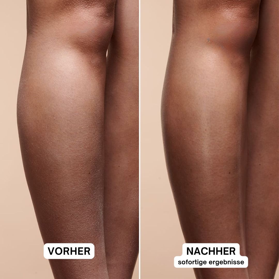 Beine vor und nach der Anwendung. Vorher: trockene Haut. Nachher: glatte Haut.