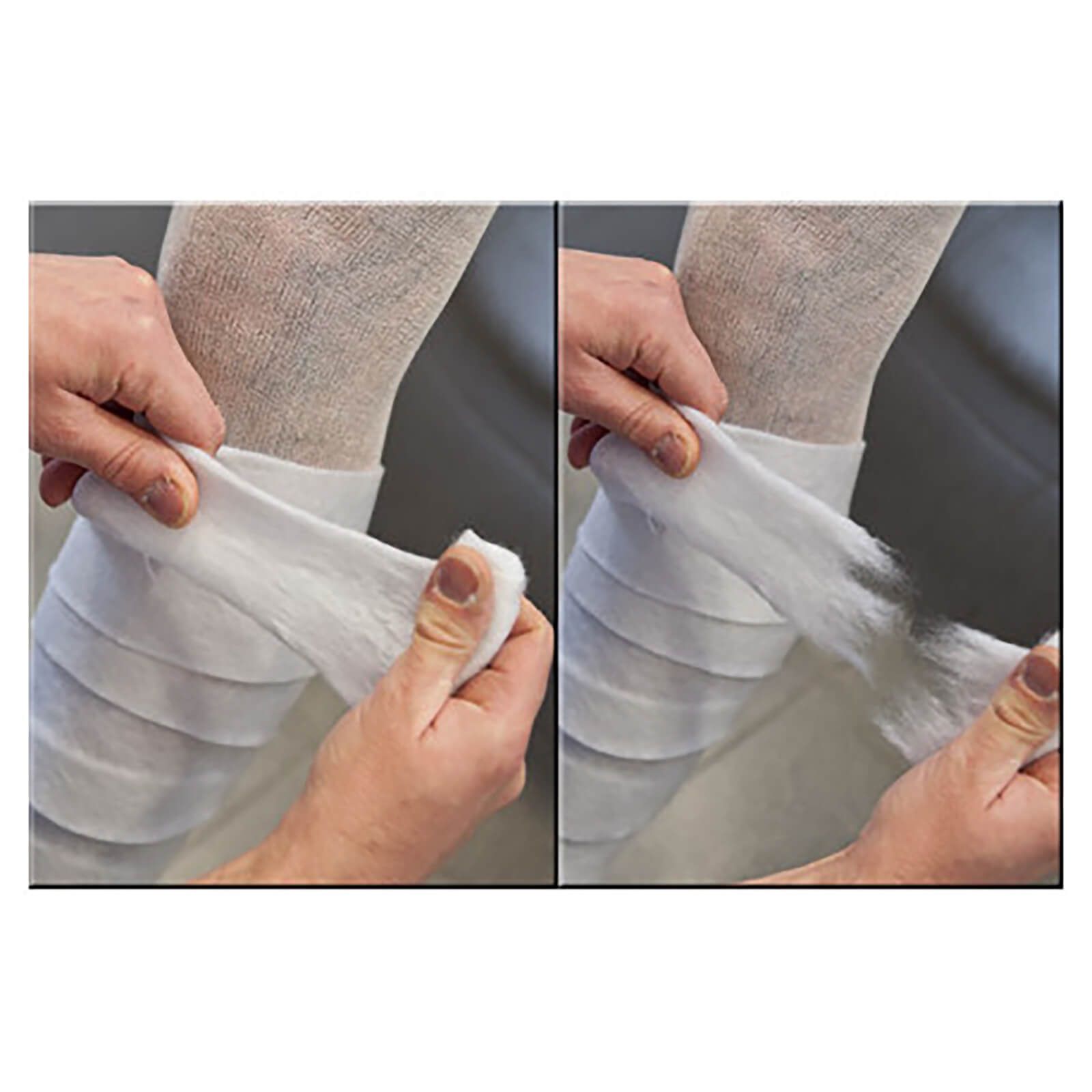 Zwei Hände wickeln einen weißen Verband um ein Bein.