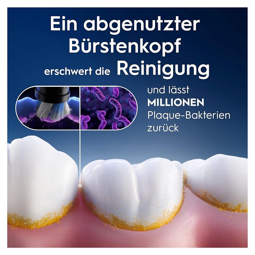 Abgenutzter Bürstenkopf erschwert Reinigung und lässt Plaque-Bakterien zurück.