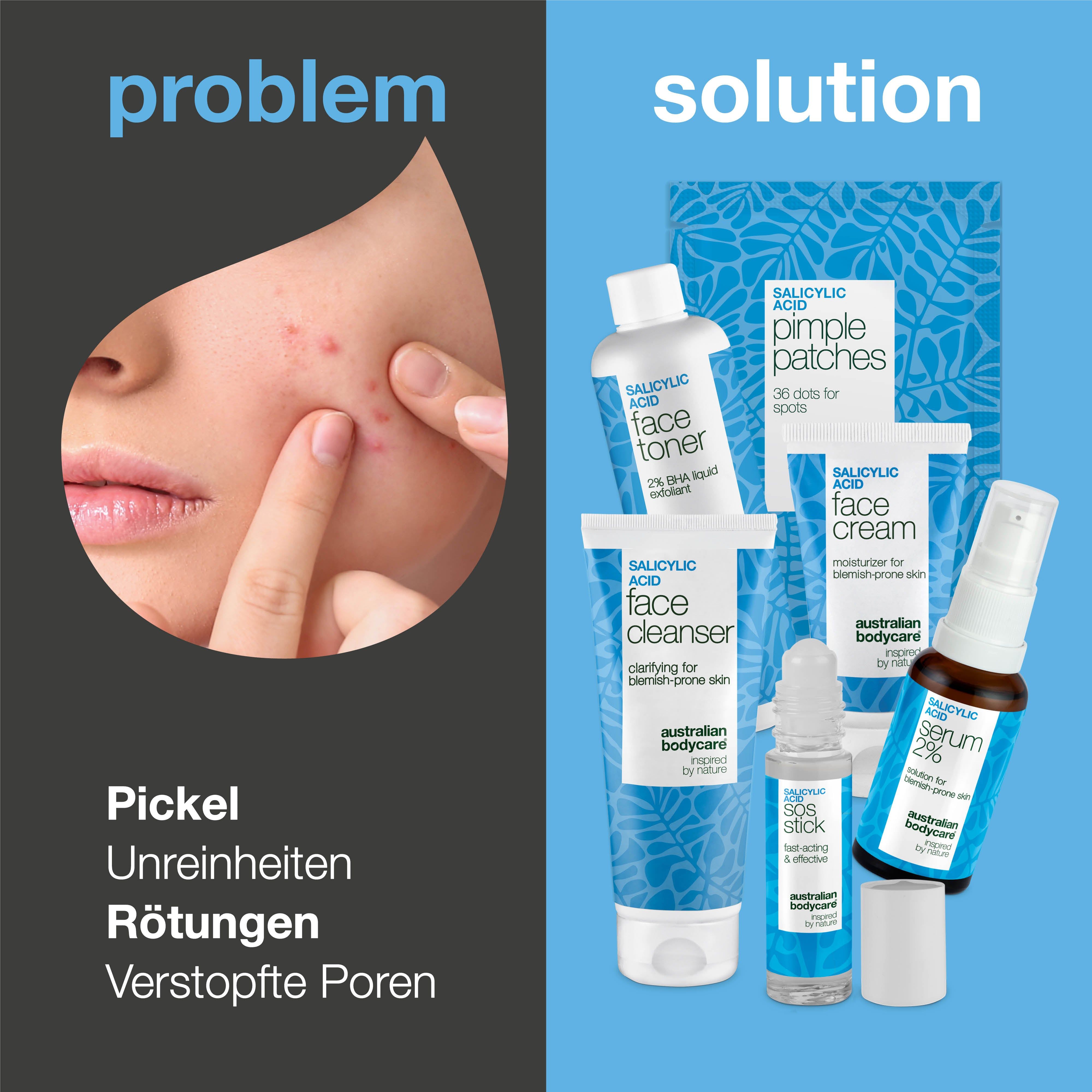 Gesicht mit Pickeln. Produkte: Toner, Pflaster, Creme, Serum, Stick. Text: 'Pickel, Unreinheiten'.
