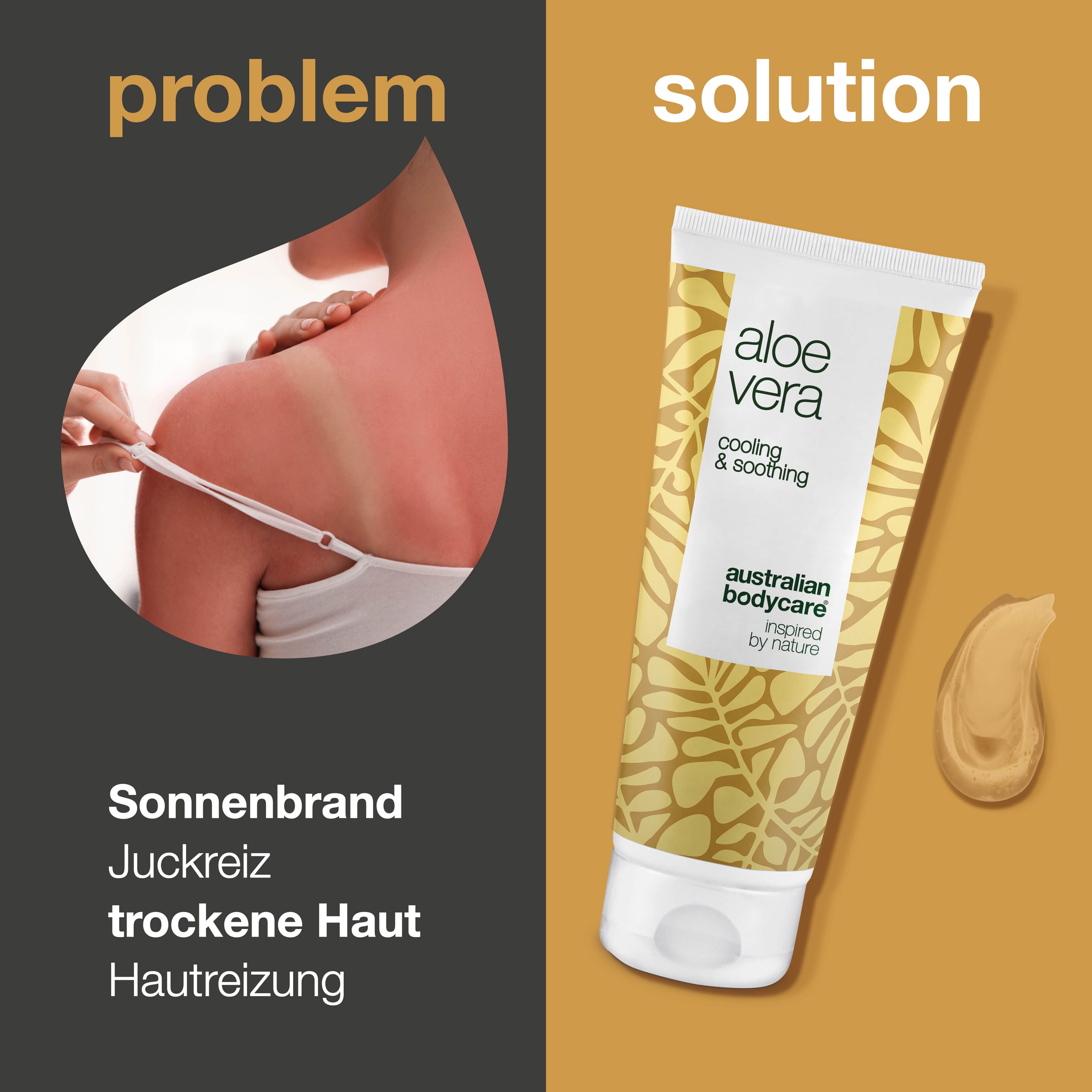 Vergleich: Sonnenbrand vs. Aloe Vera Gel. Tube Aloe Vera, Text: cooling & soothing, Australian Bodycare.