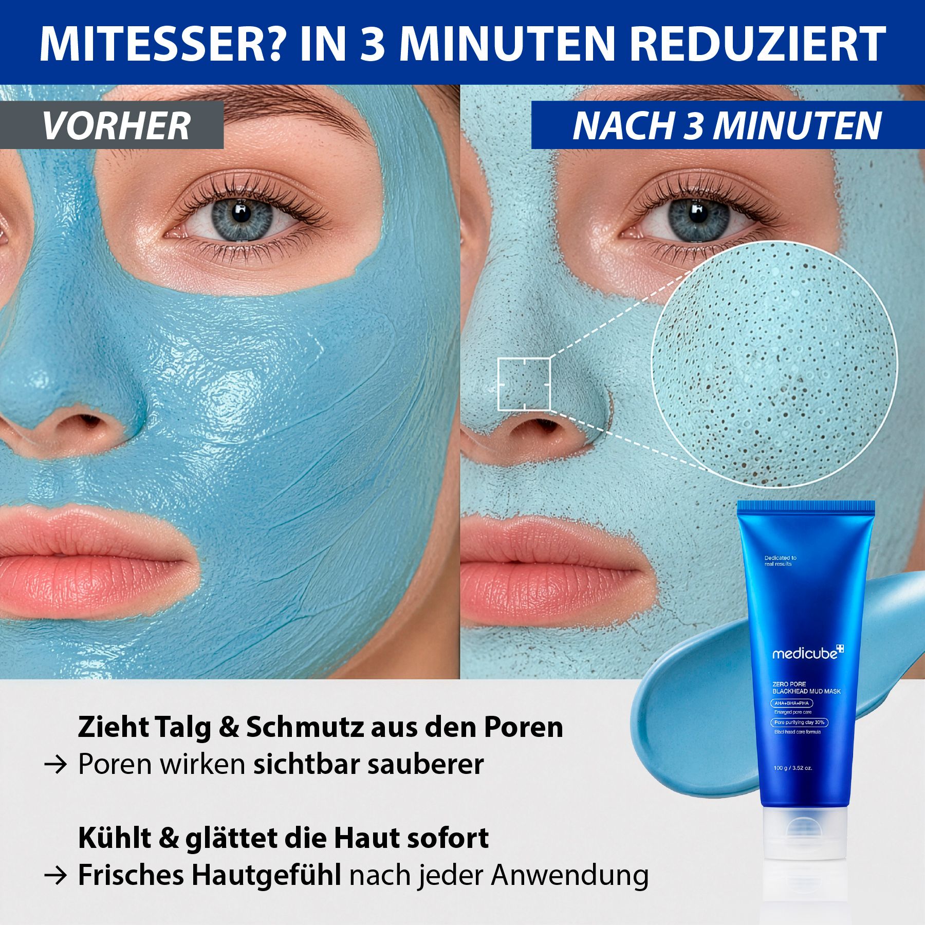Medicube Zero Pore Blackhead Musk Mitesser Porenreinigender Gesichtsmaske