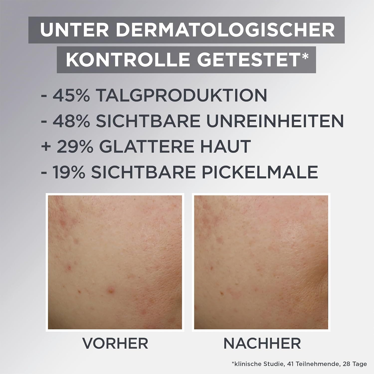 Vorher-Nachher-Vergleich von Haut. Ergebnisse: -45% Talgproduktion, -48% Unreinheiten, +29% glattere Haut, -19% Pickelmale.