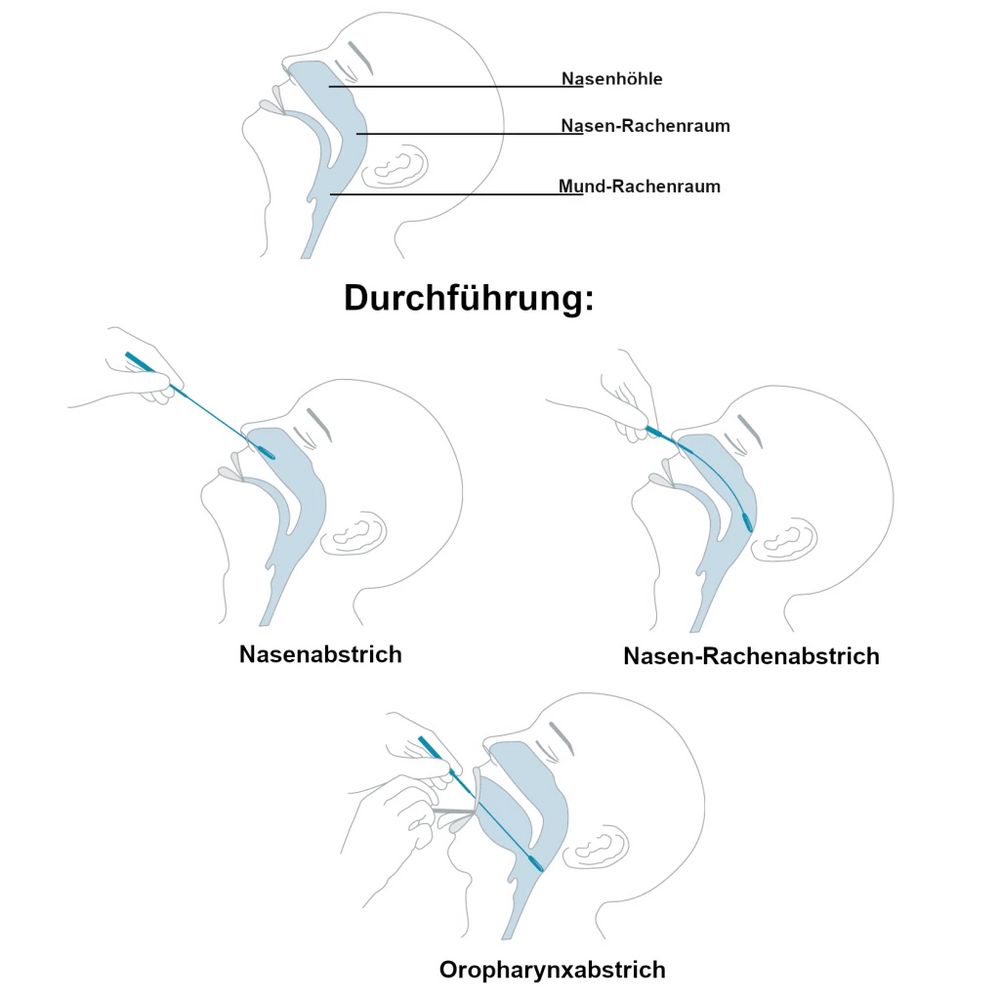 Clungene Antigen COVID-19 Schnelltest - 3in1 Professional + Gratis Nanovio FFP2