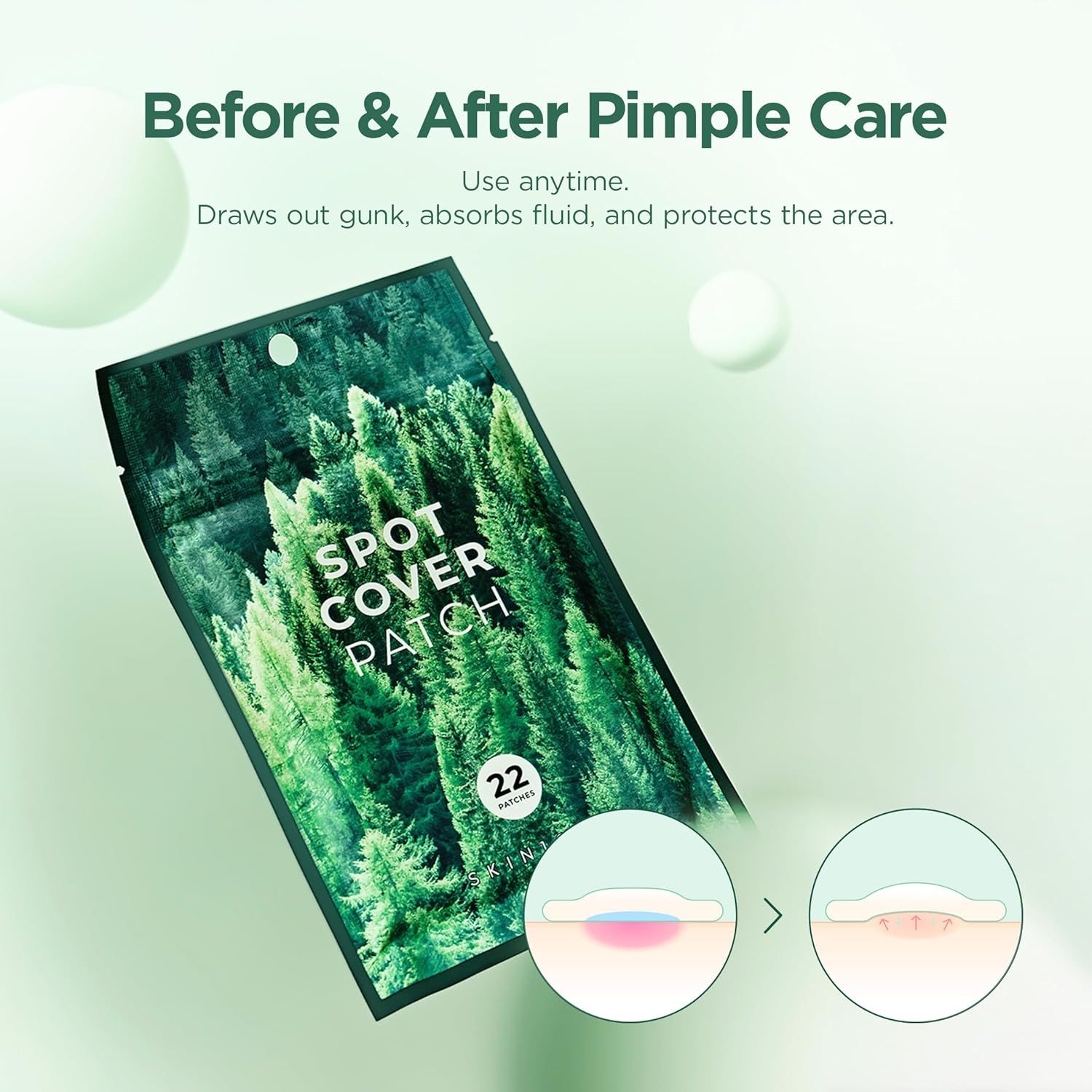 Skin1004 Spot Cover Patch