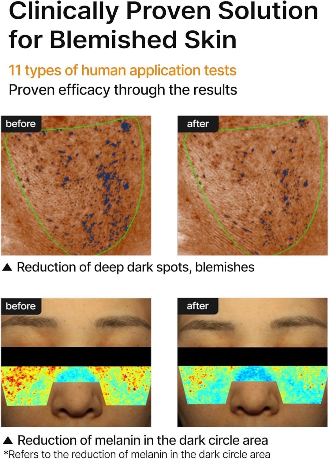 Vorher-Nachher-Bilder zeigen Hautverbesserung. Reduzierung dunkler Flecken und Melanin in Augenpartie.