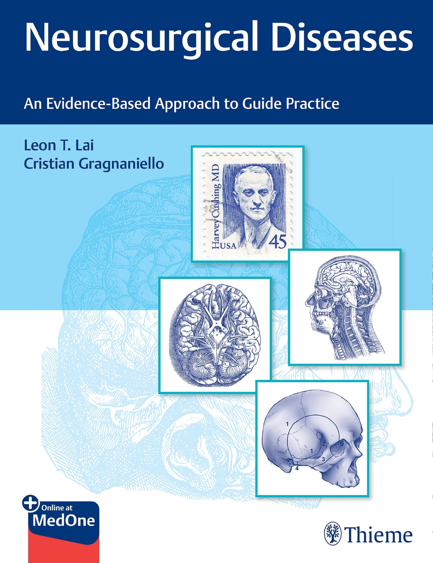 Buchcover: Neurosurgical Diseases. Autoren: Leon T. Lai, Cristian Gragnaniello. Verlag Thieme. Abbildungen von Gehirn und Schädel.