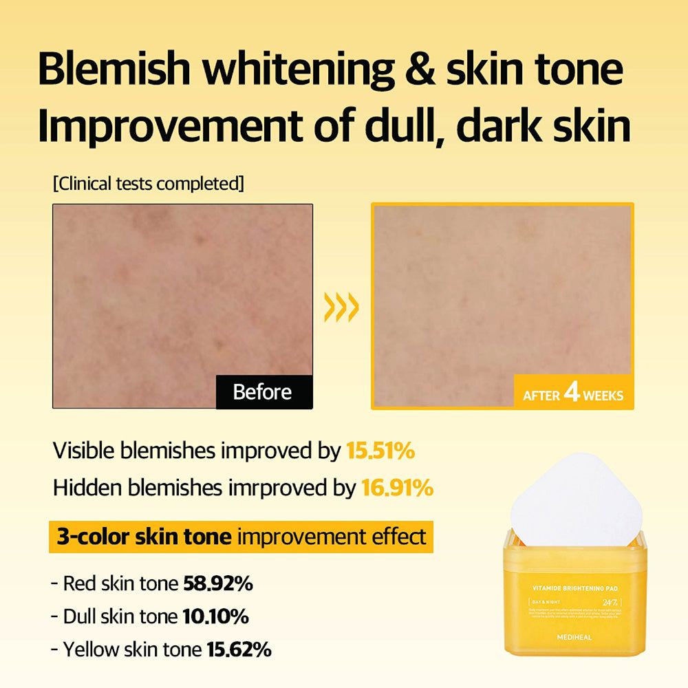 Vorher-Nachher-Vergleich von Haut. Gelbe Dose mit Pads. Text: Vitamide Brightening Pad. Ergebnisse: Verbesserung von Hautunreinheiten und Hautton.
