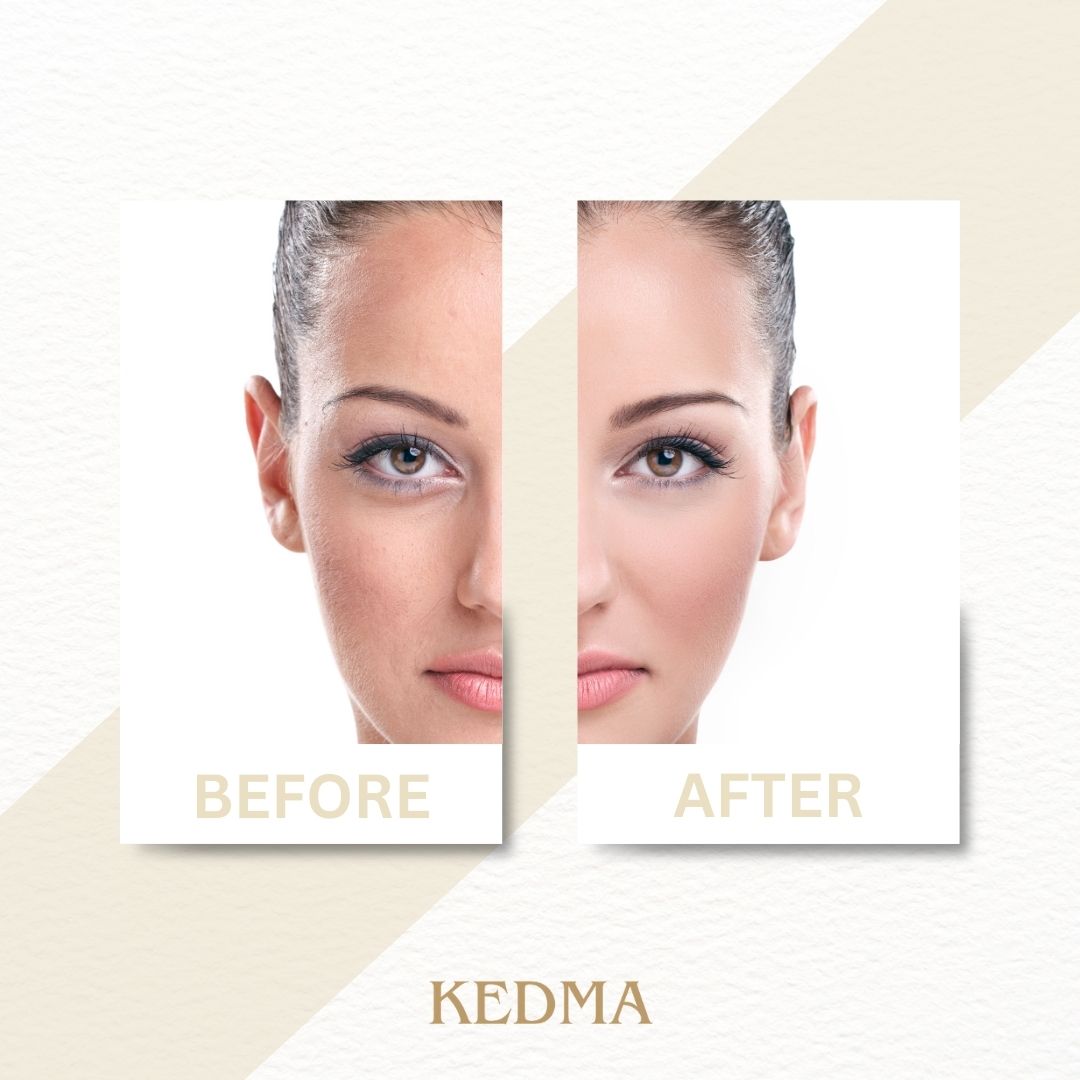 Kedma - Fußcreme mit Mineralien