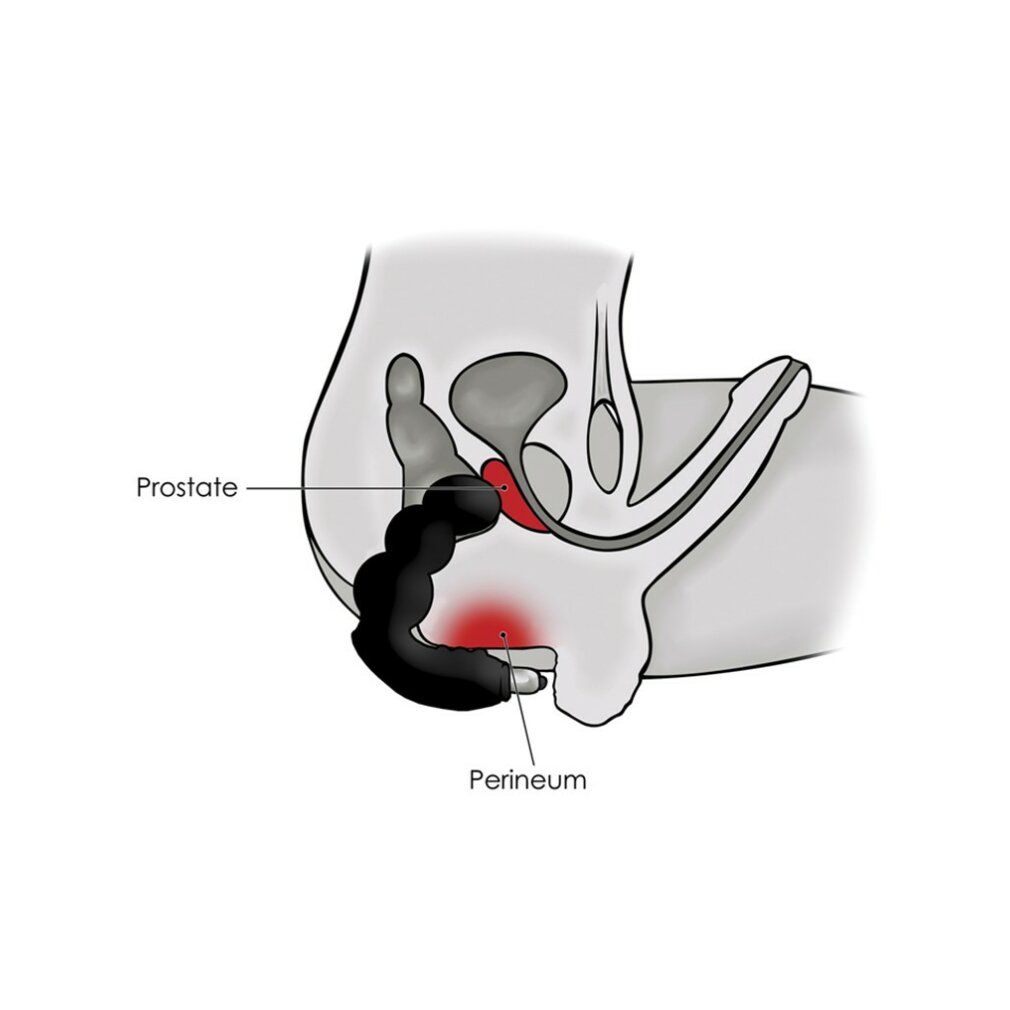 Illustration des männlichen Beckens. Der Vibrator wird in der Nähe der Prostata positioniert. Beschriftungen: Prostata, Perineum.