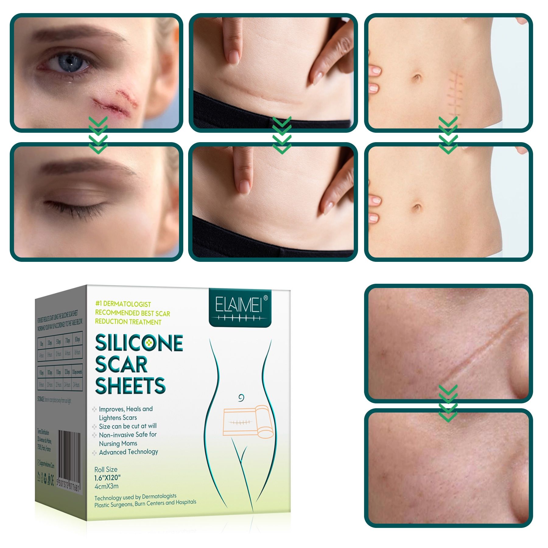 P-Beauty Silikonpflaster Narbenpflaster Wundpflaster