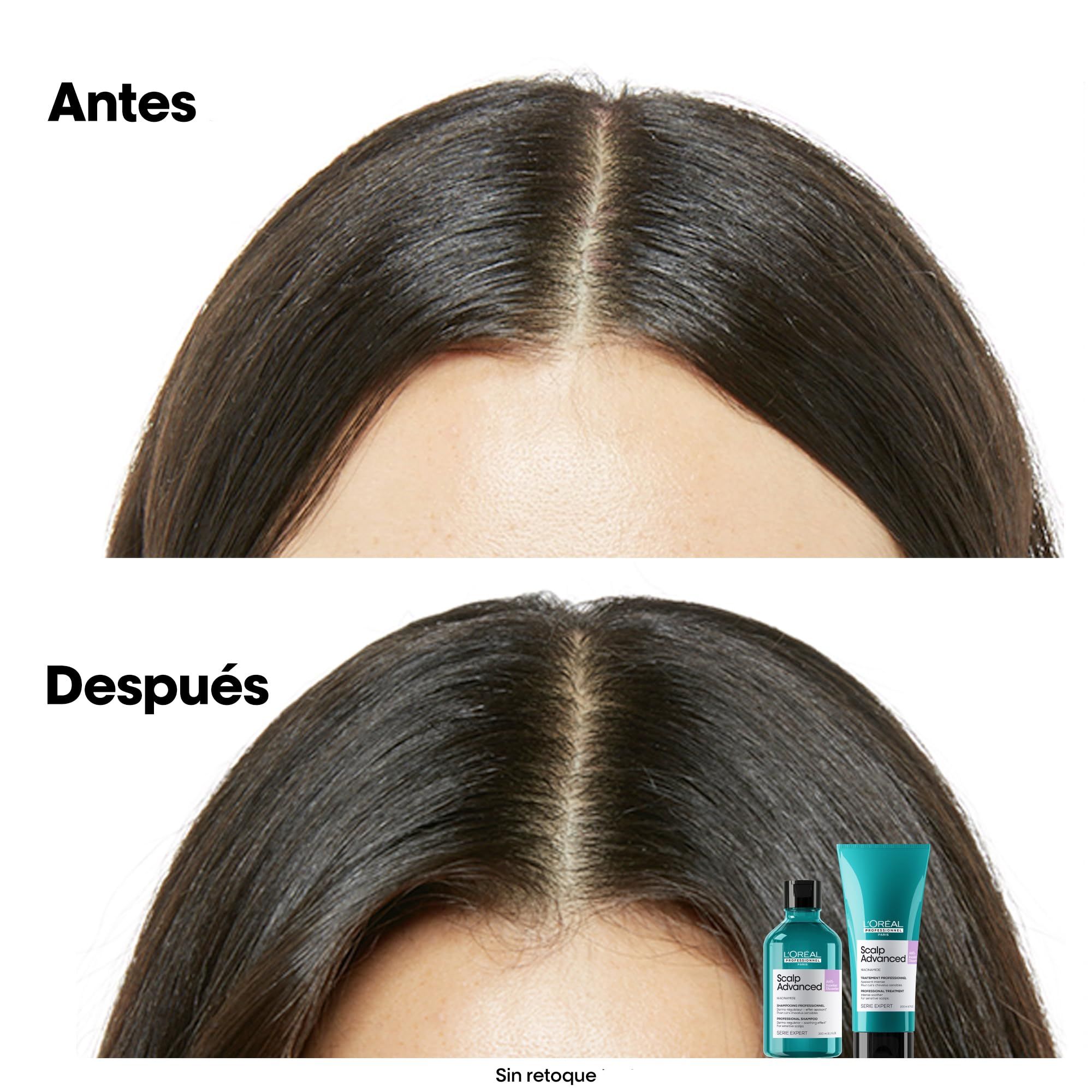 Zwei Bilder von Haaren. Oben: Vorher. Unten: Nachher. Daneben: Shampoo- und Maskenflasche. Text: Ohne Retusche.