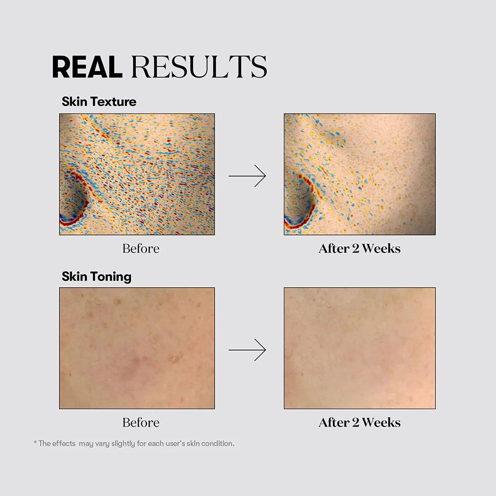 VT COSMETICS TX-Toning Creme